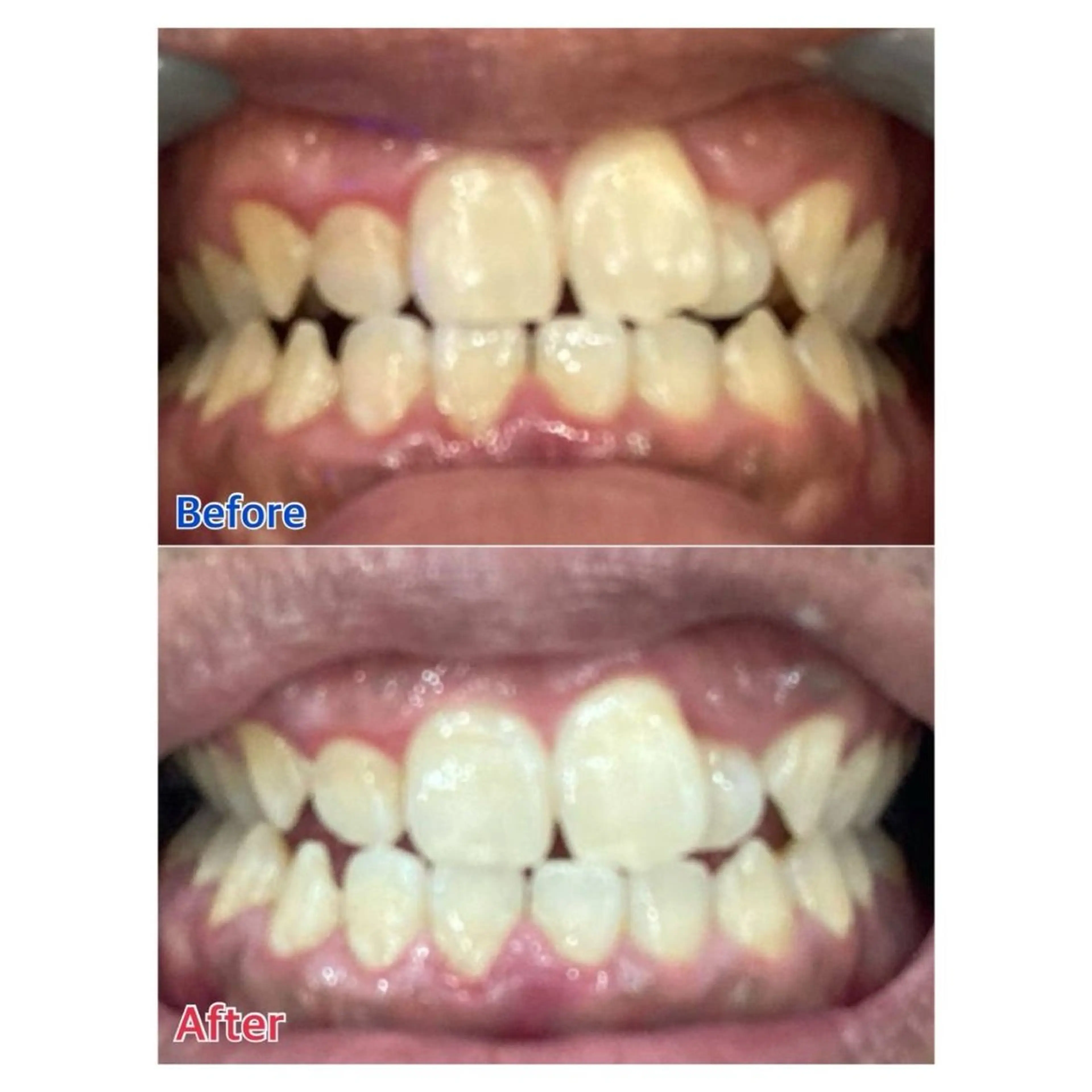 MBEAUTYSALON 千葉店・京成大久保所属・Melty 輝のその他イメージ