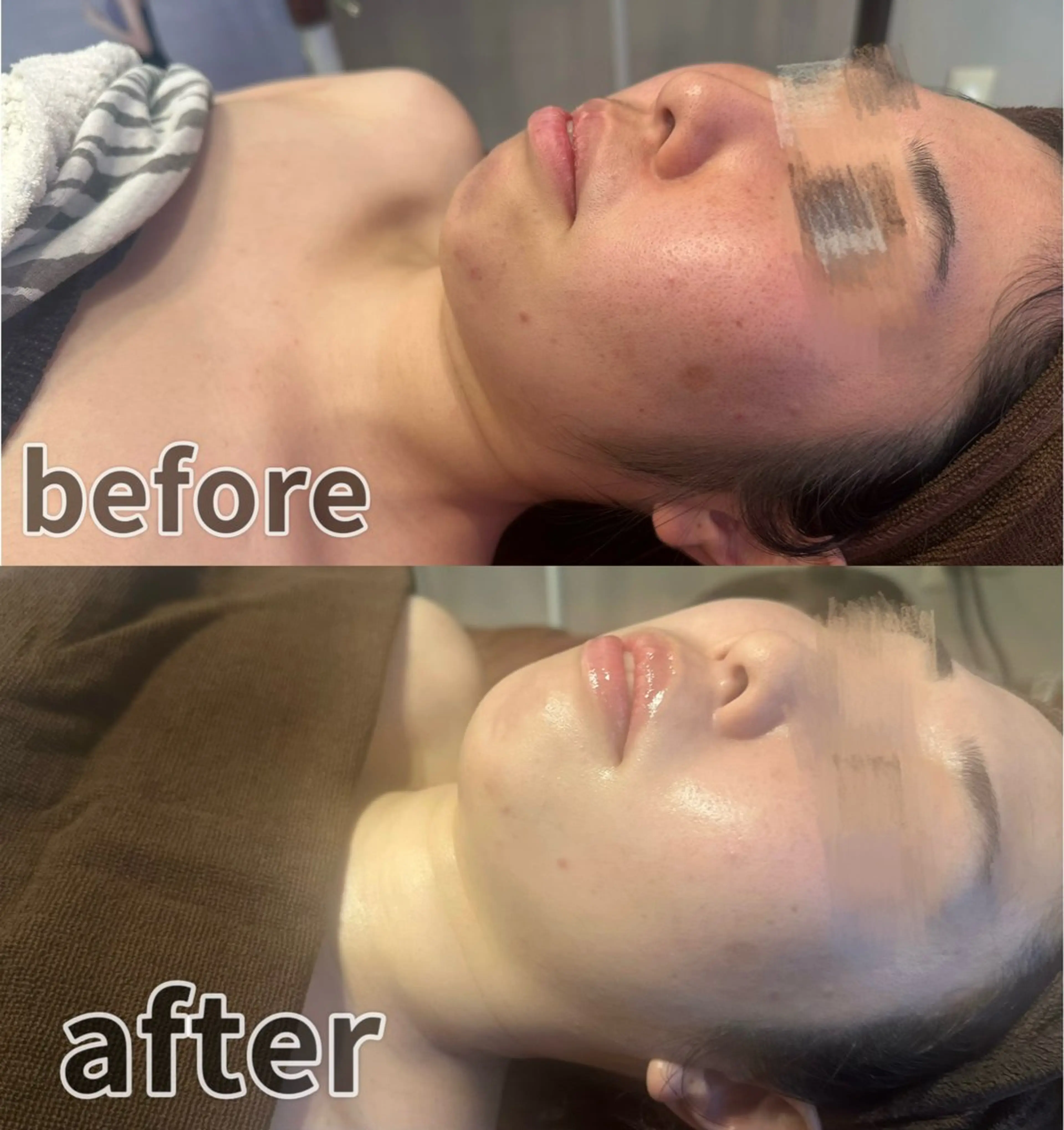 エステ 浮腫|肩こり|張り 日々の疲れを解消★のエステ・リラクイメージ