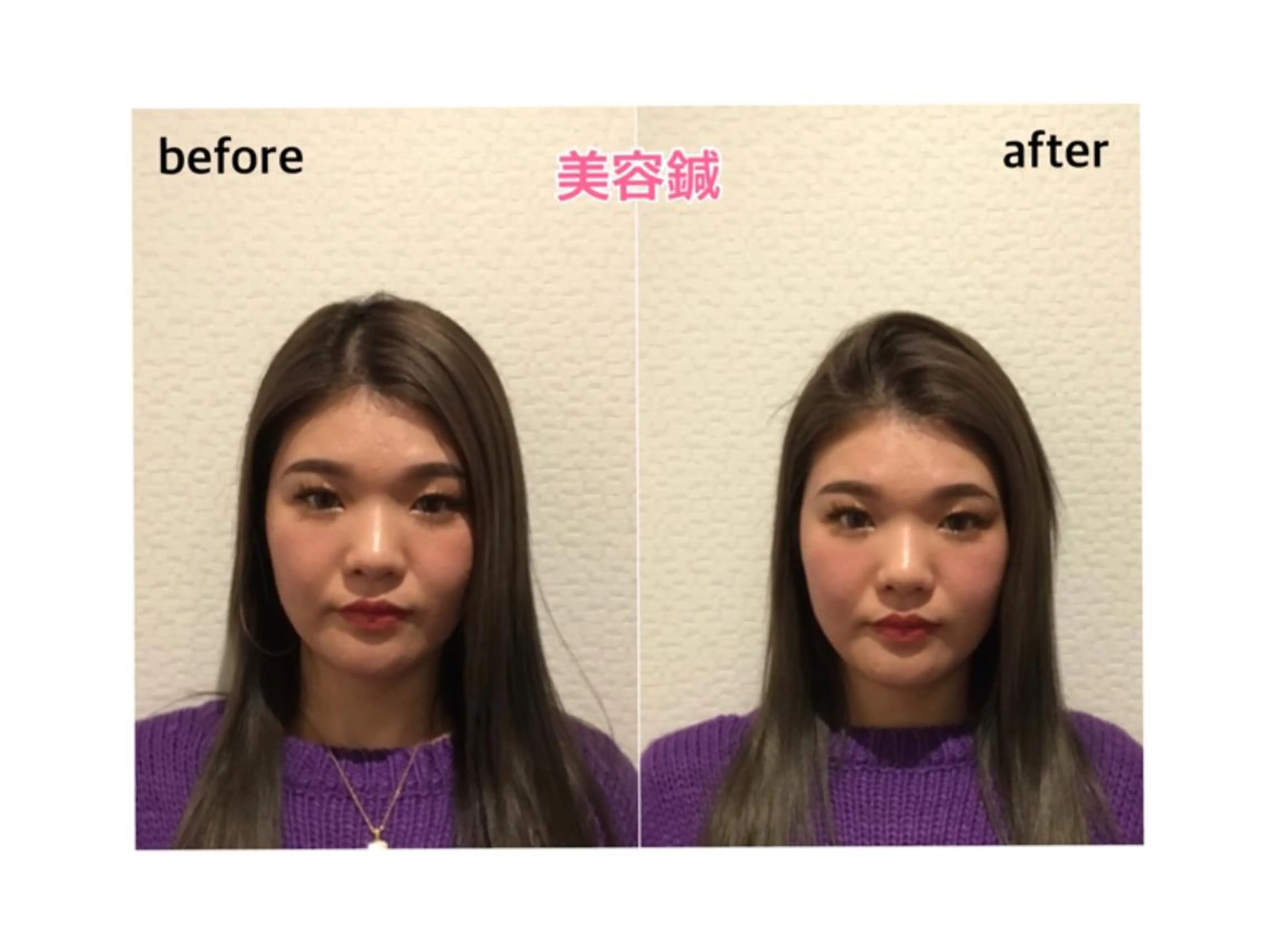 チキバン美容鍼灸整体 サロン心斎橋店のエステ・リラクイメージ