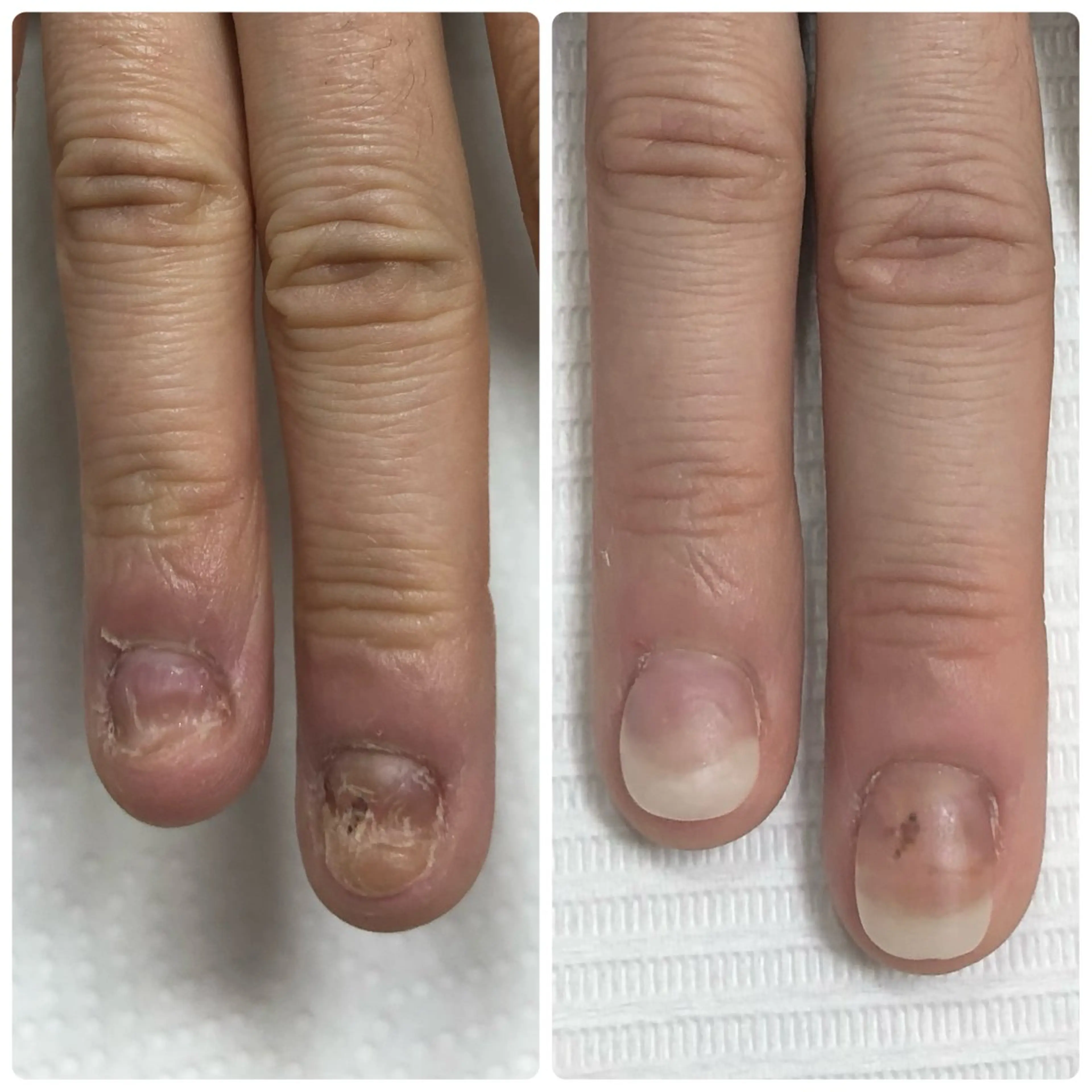 深爪矯正専門サロン リュリュ所属・深爪矯正専門サロン リュリュのネイルデザイン