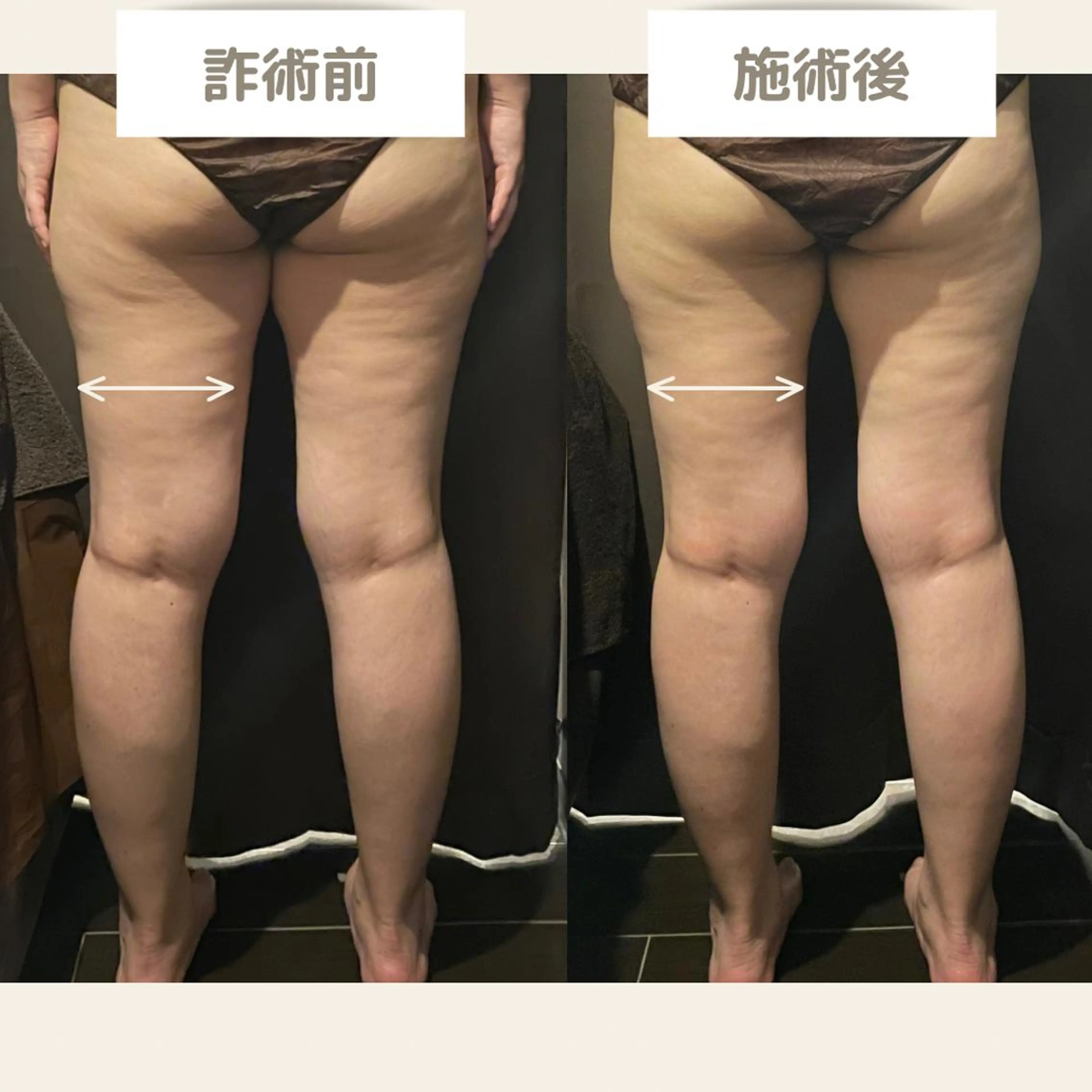 エステ if byOrab riller【ｲﾌ】のその他イメージ