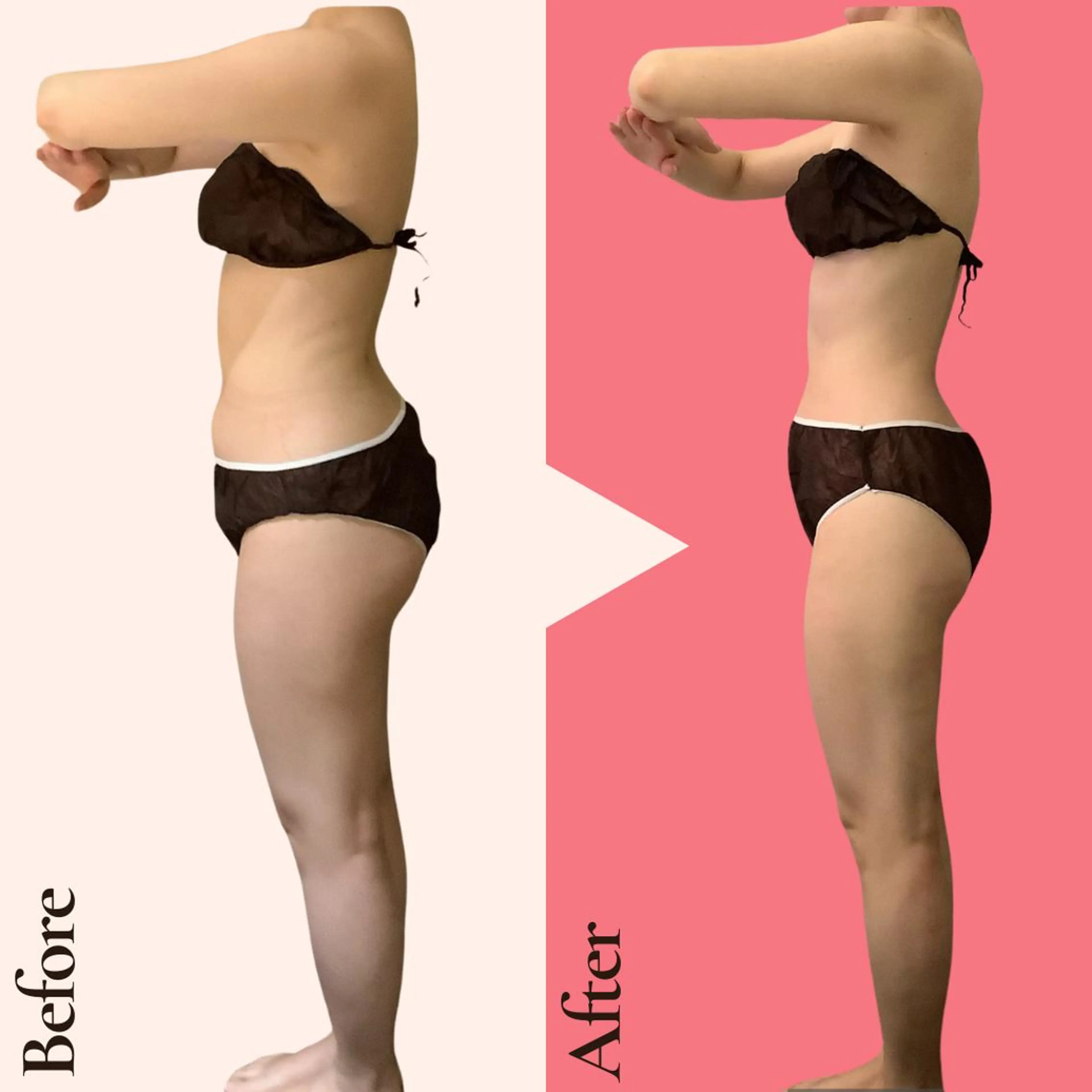 エステ リラク 痩身ダイエット専門店 プレシャスのエステ・リラクイメージ