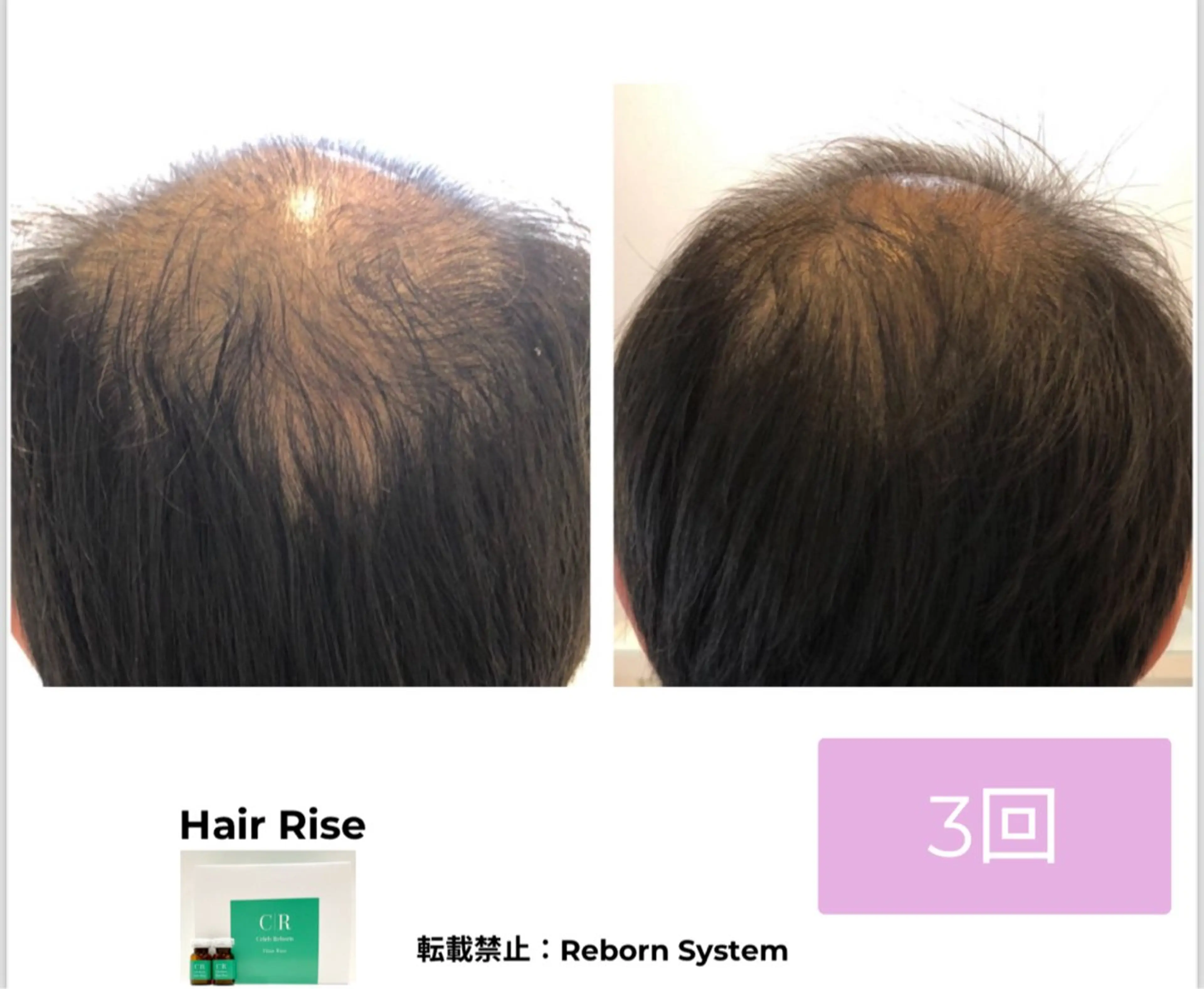 【福岡市西区 エステ】 GRANVIR(グランヴィール)所属・GRANVIR グランヴィールのエステ・リラクイメージ