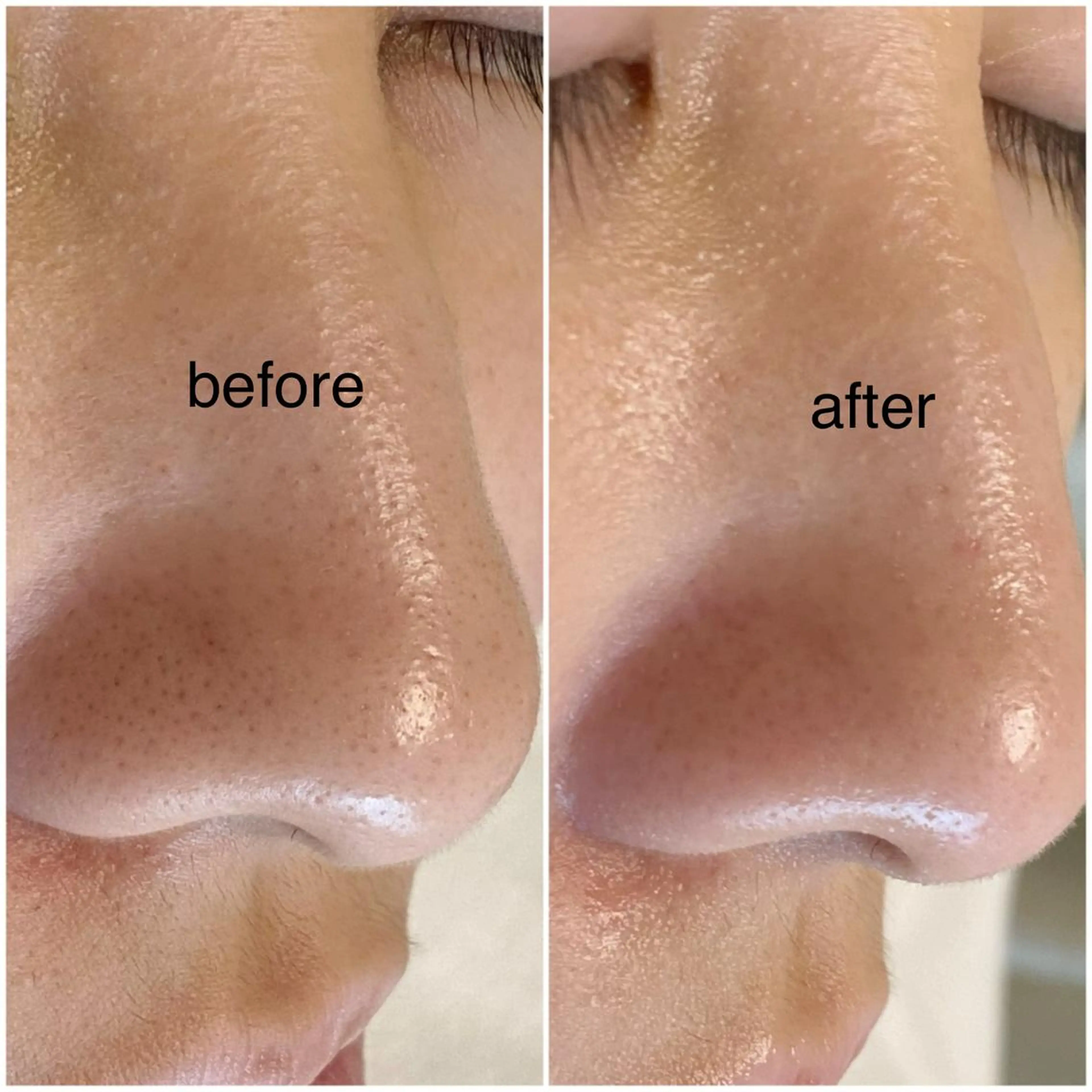 毛穴専門サロン フルール所属・フルールFululu 自由が丘のエステ・リラクイメージ