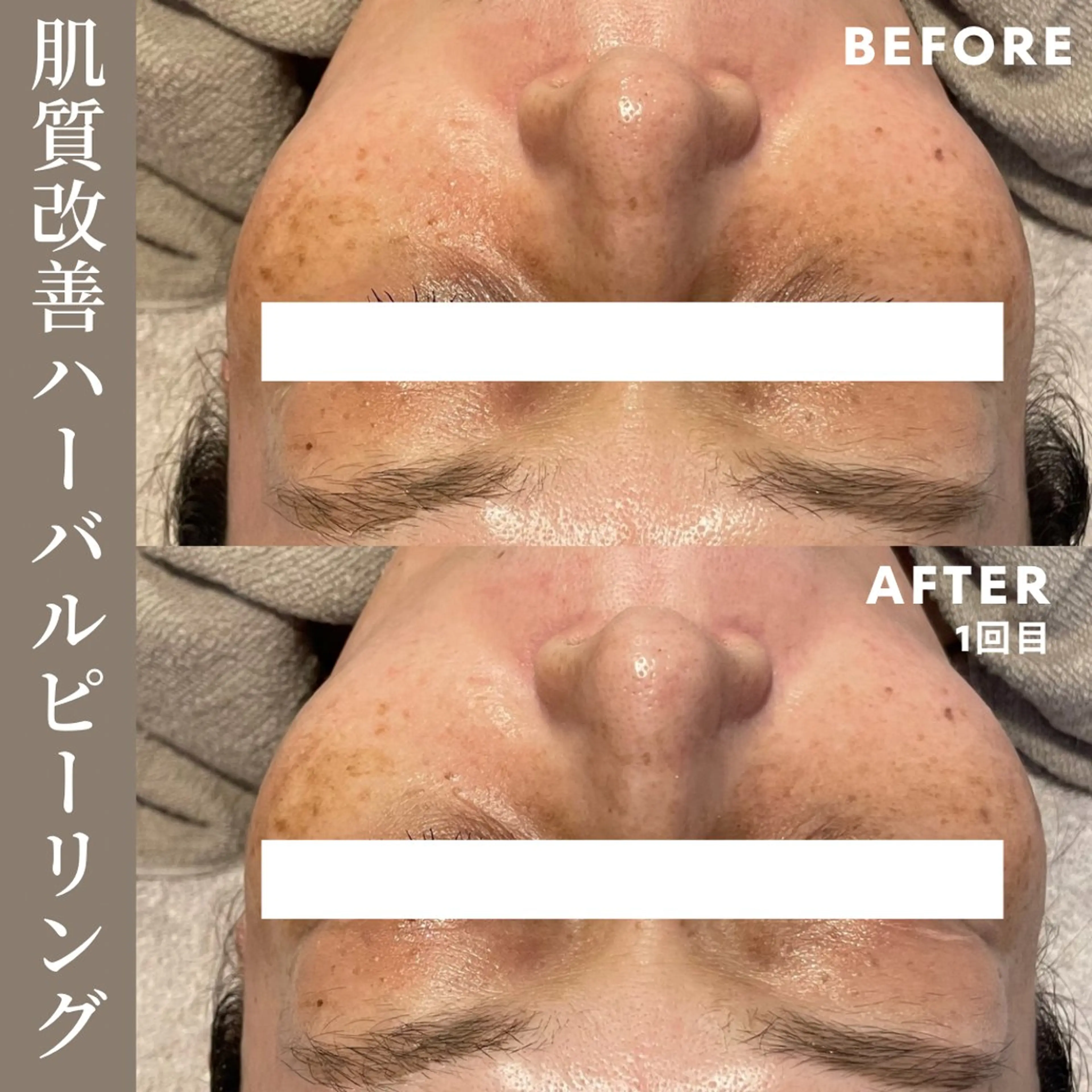 エステ Lassy Yuriの眉毛・アイブロウイメージ