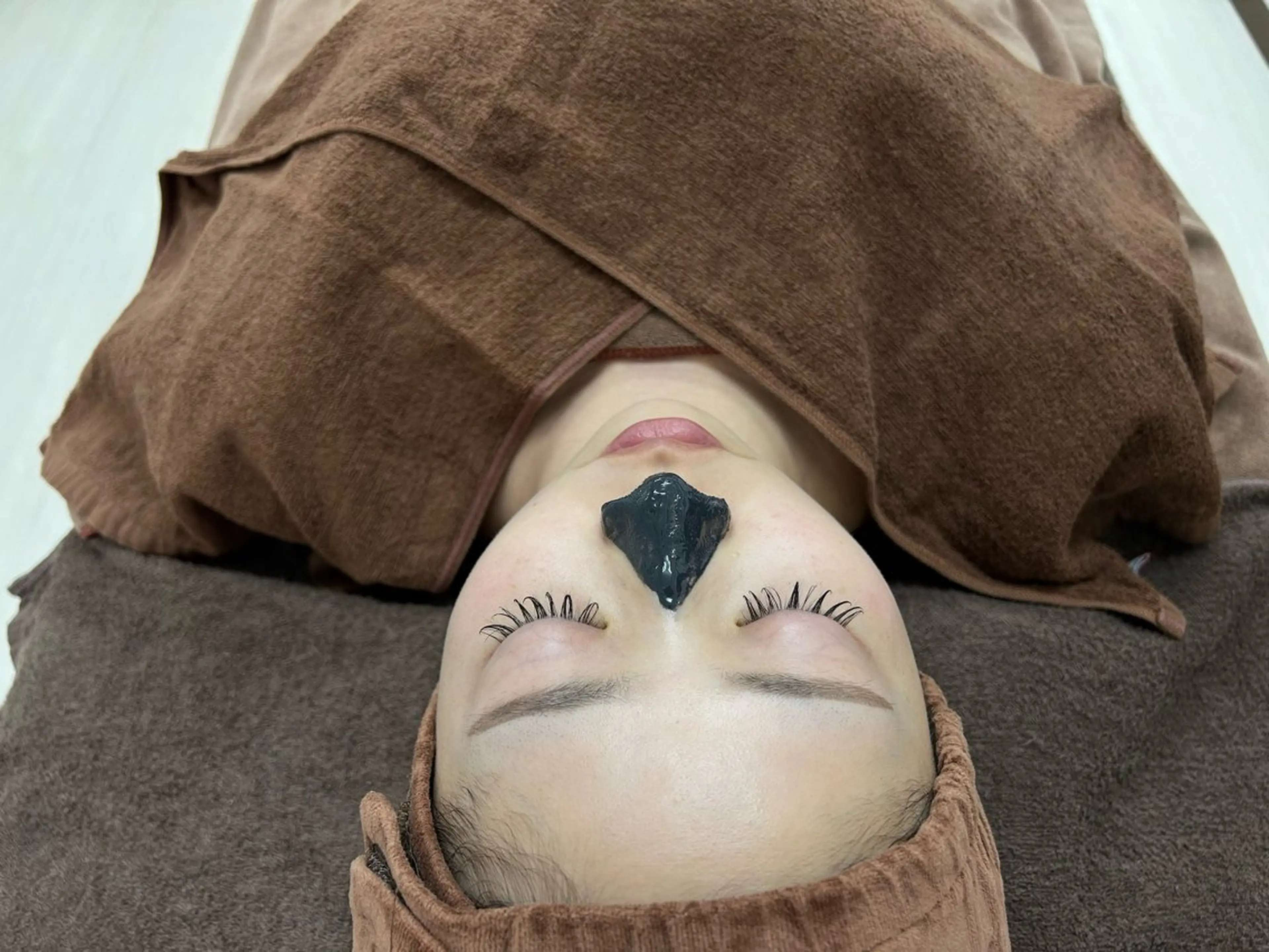 毛穴洗浄&ひきしめ美容鍼コースの写真