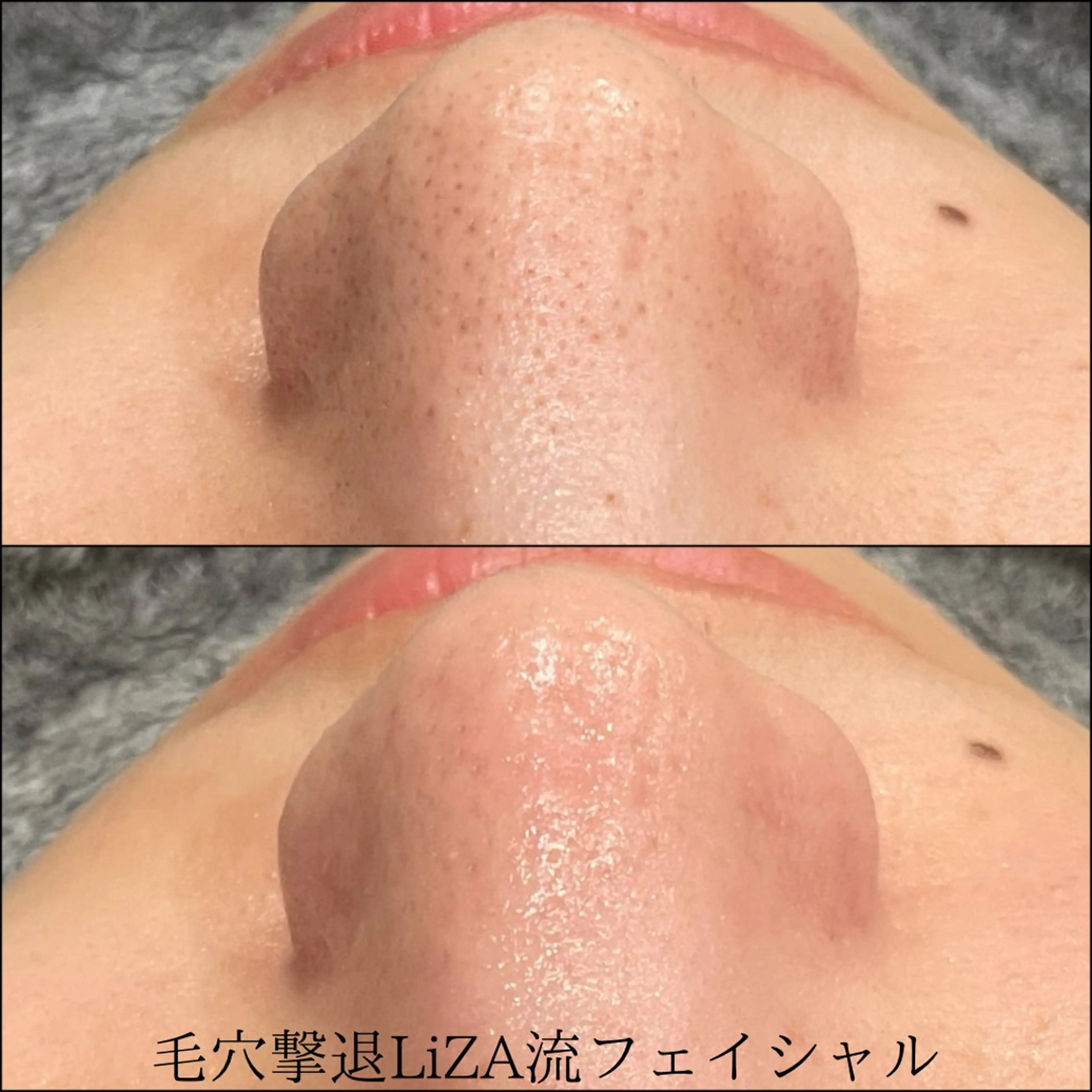 エステ LiZA エステティックサロンのエステ・リラクイメージ