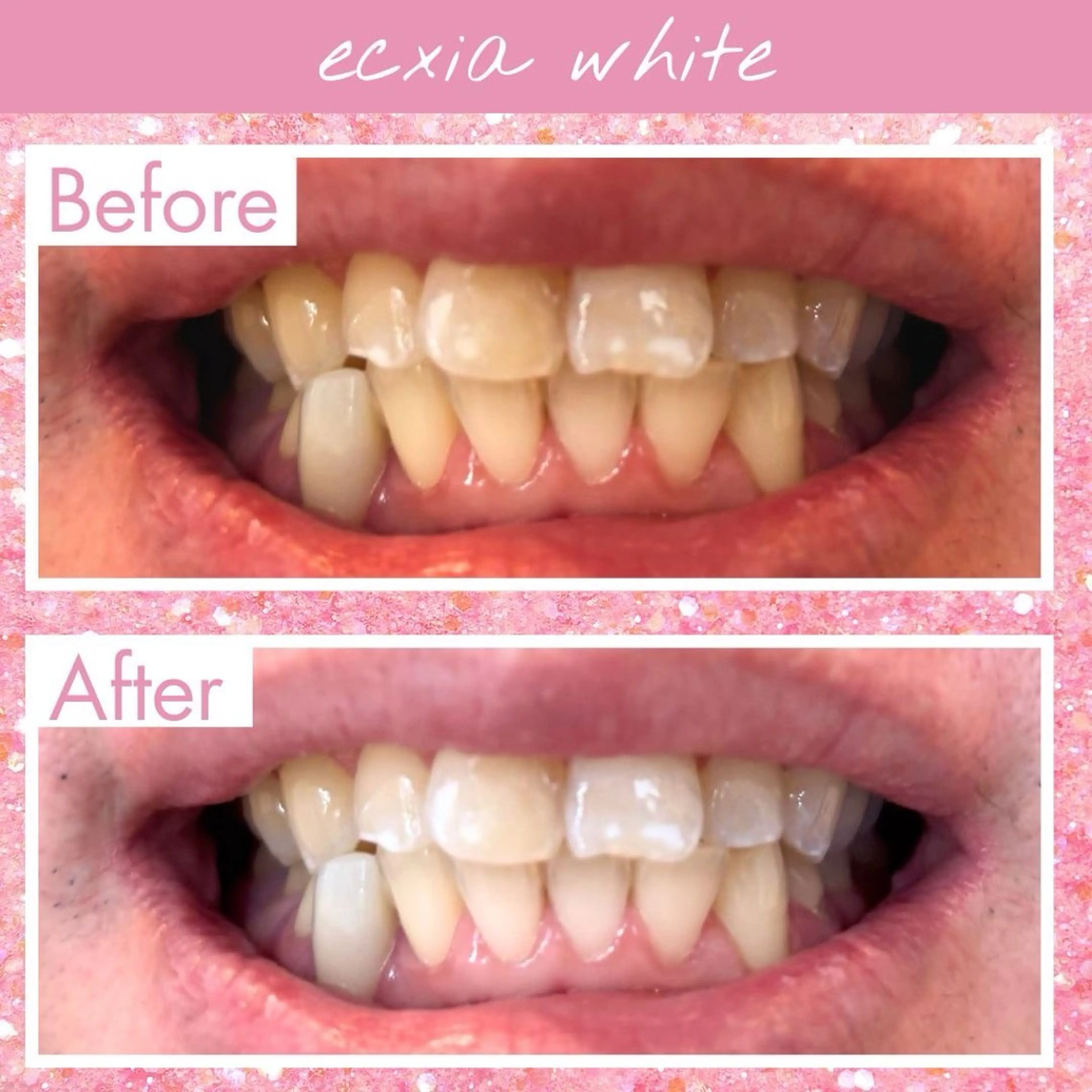 セルフホワイトニング エクシア仙台駅東口店のその他イメージ