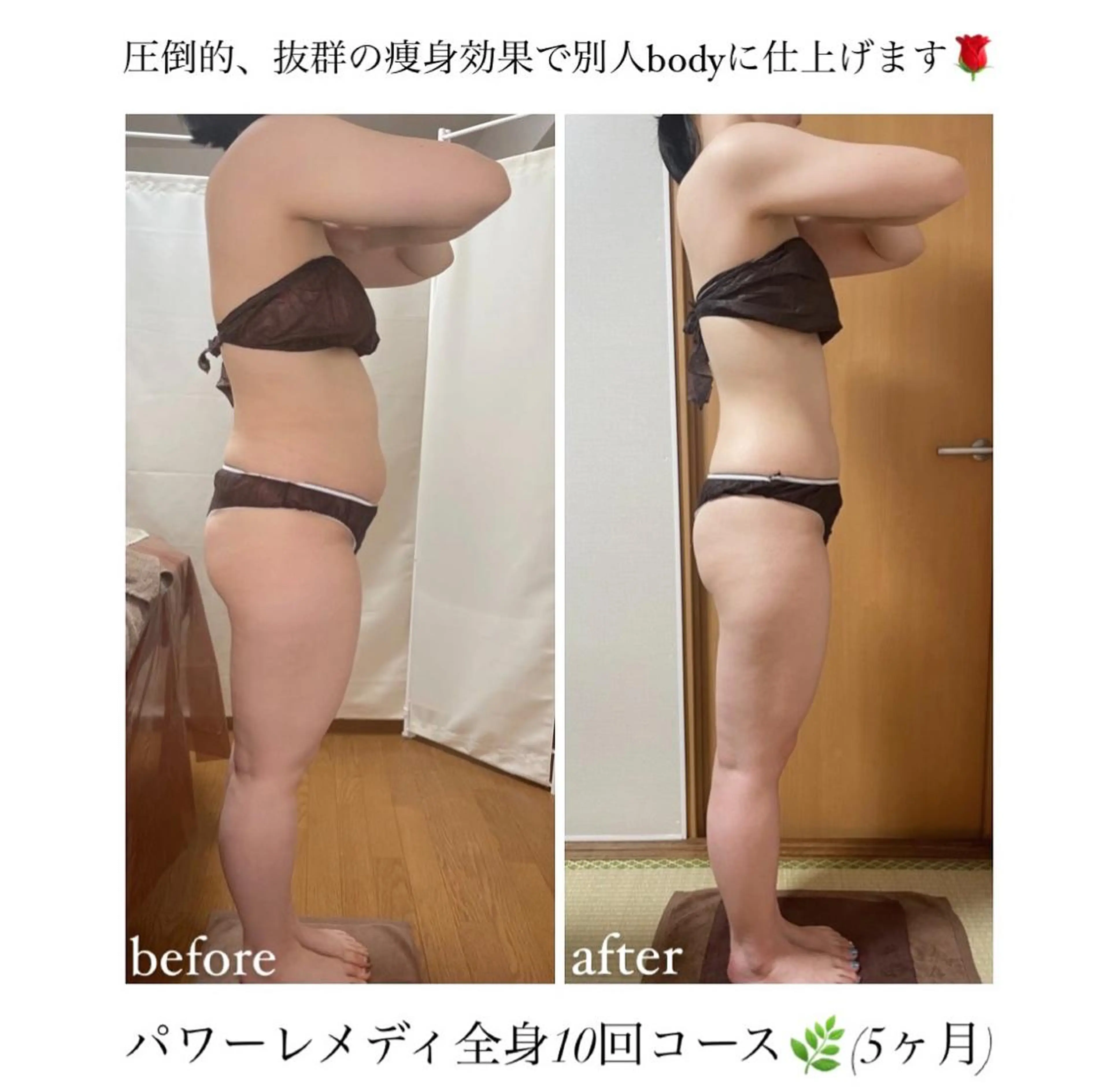 《本気痩せ×疲労改善 》  BILOOPのエステ・リラクイメージ