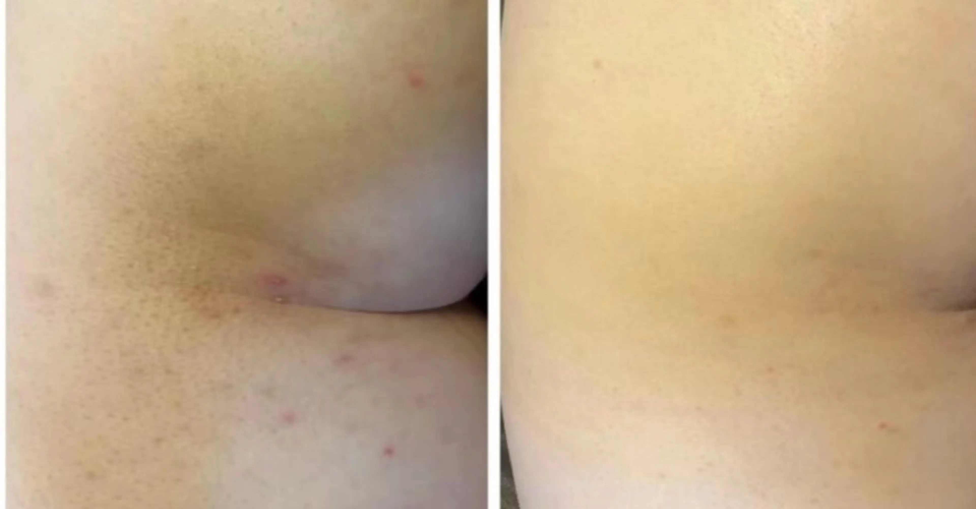 エステ べアール所属・小顔/毛穴/ニキビ salon bealのエステ・リラクイメージ