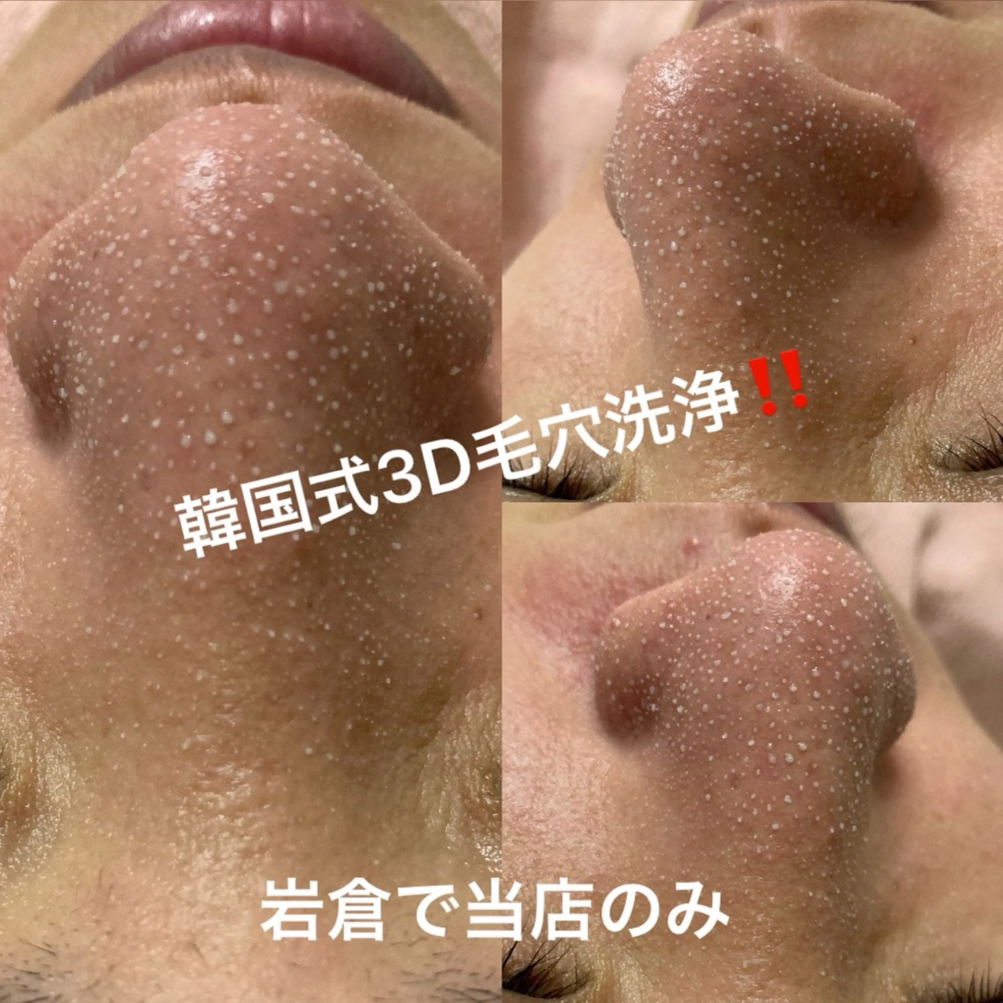 今話題の❗️韓国式3D毛穴洗浄‼️岩倉では当店のみの写真
