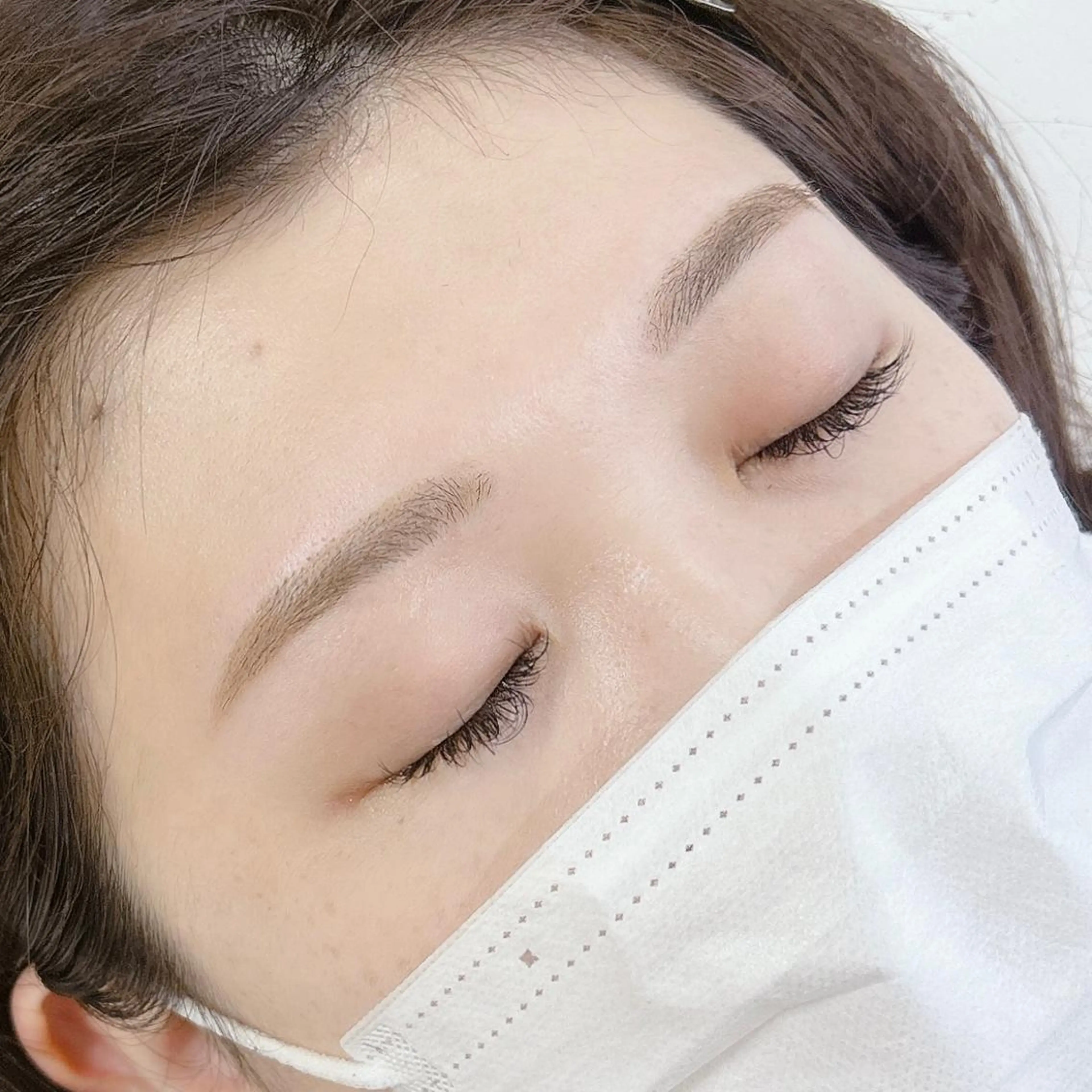 フルフェイスWax脱毛《額&フェイスライン&Cライン&鼻下&鼻&口下》の写真