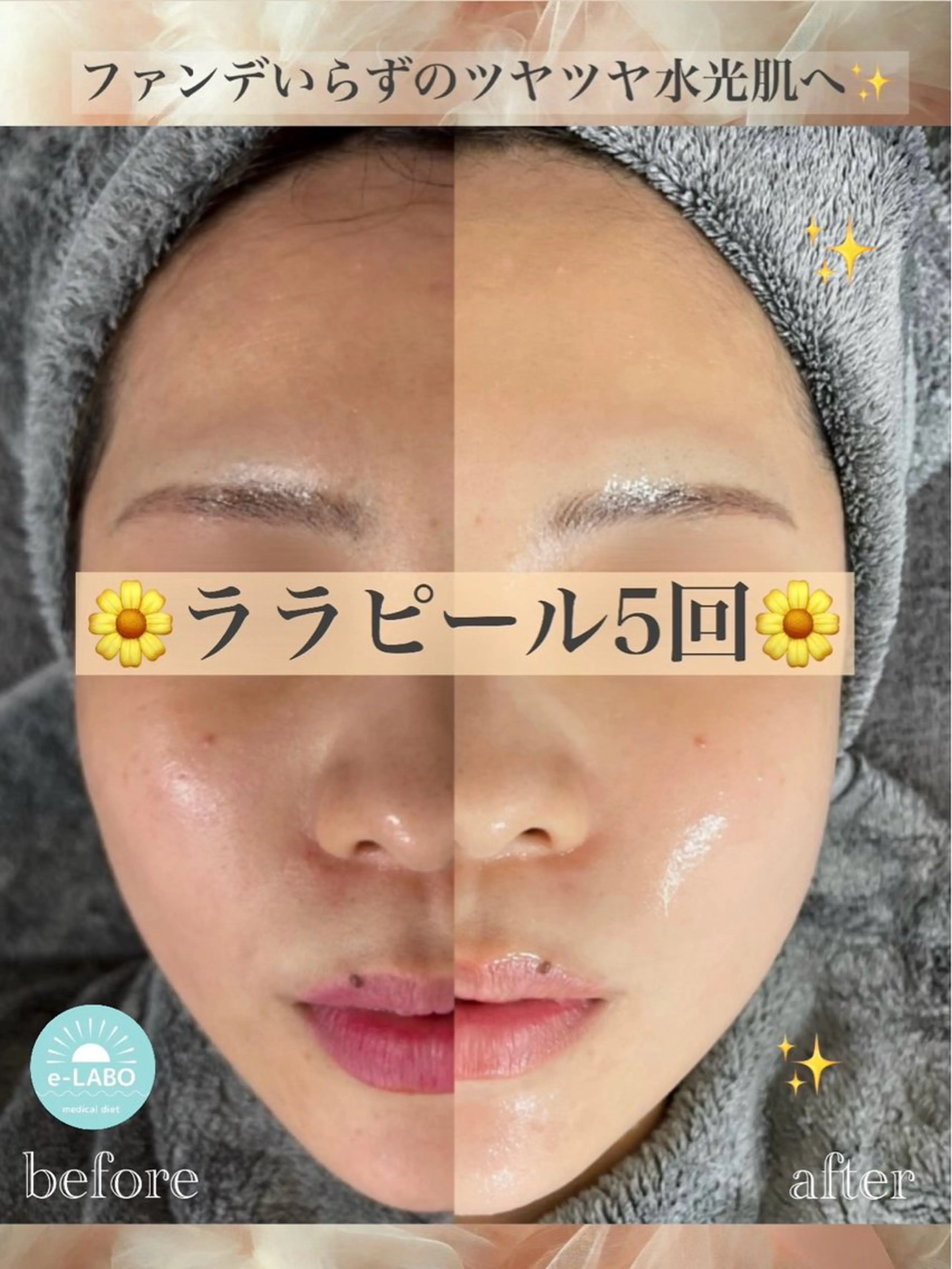 エステ e-LABO 池袋のその他イメージ