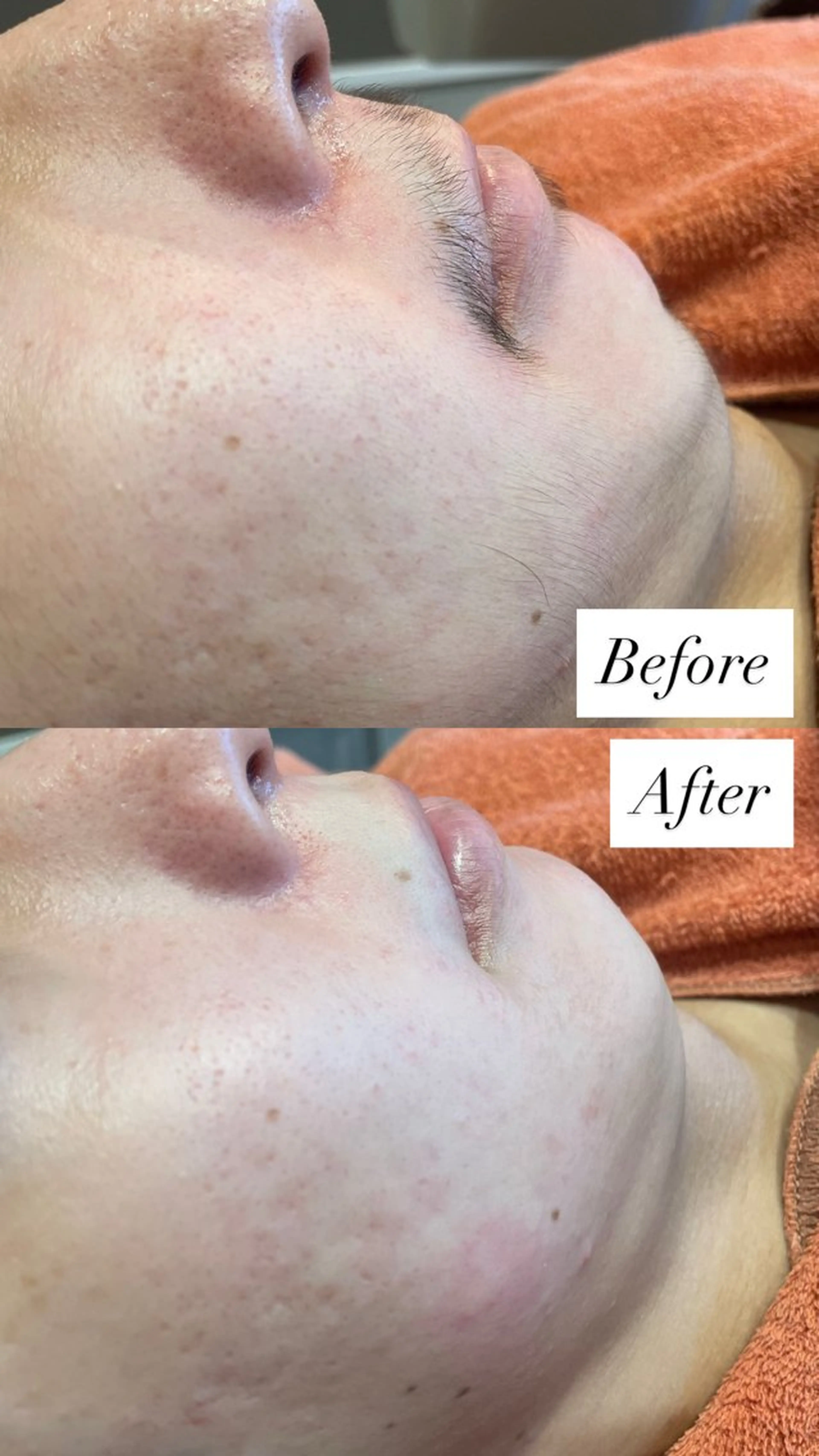 シェービングサロン UreBelleのその他イメージ