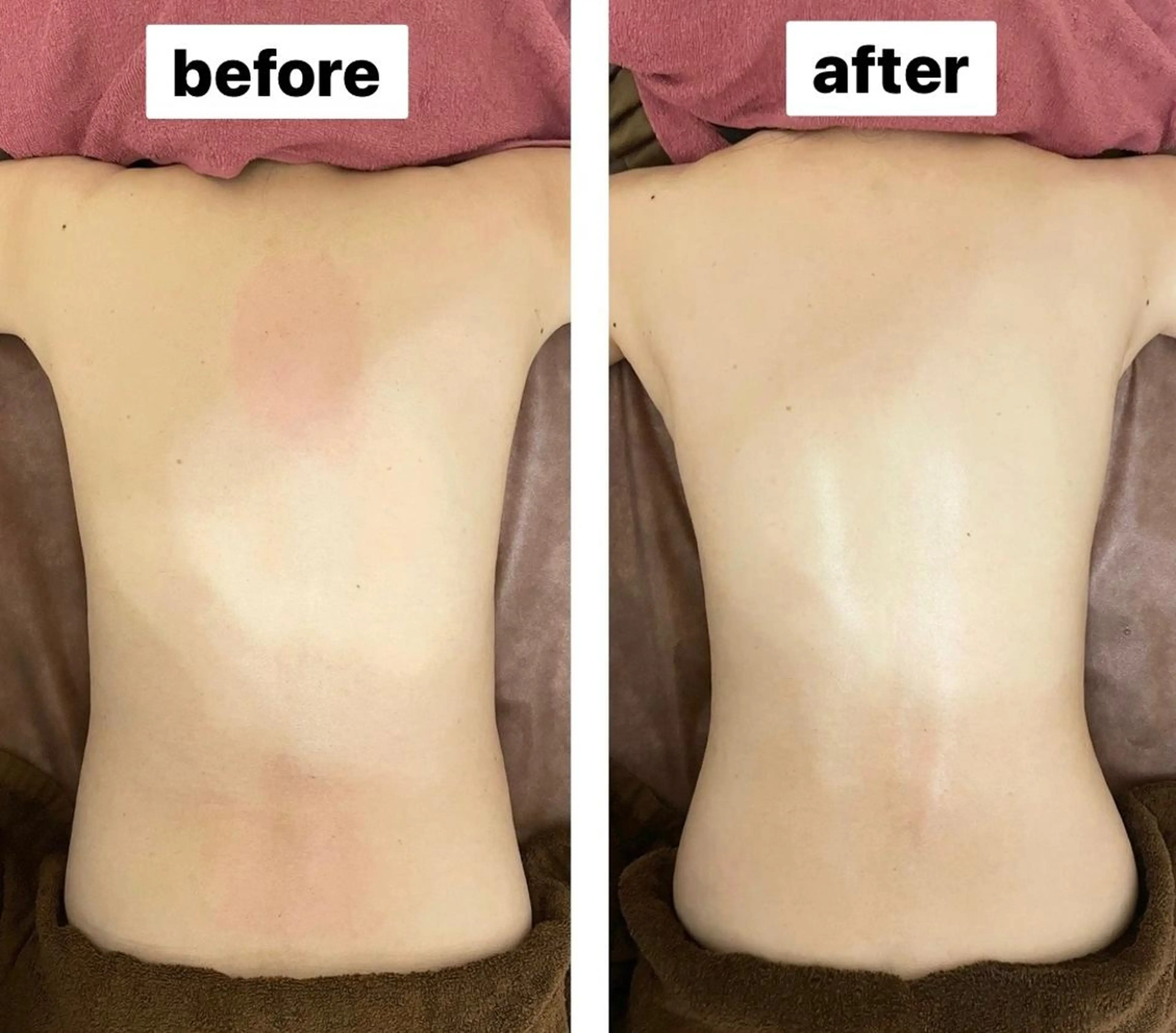 エステ 35歳からの エイジングケアサロンのエステ・リラクイメージ