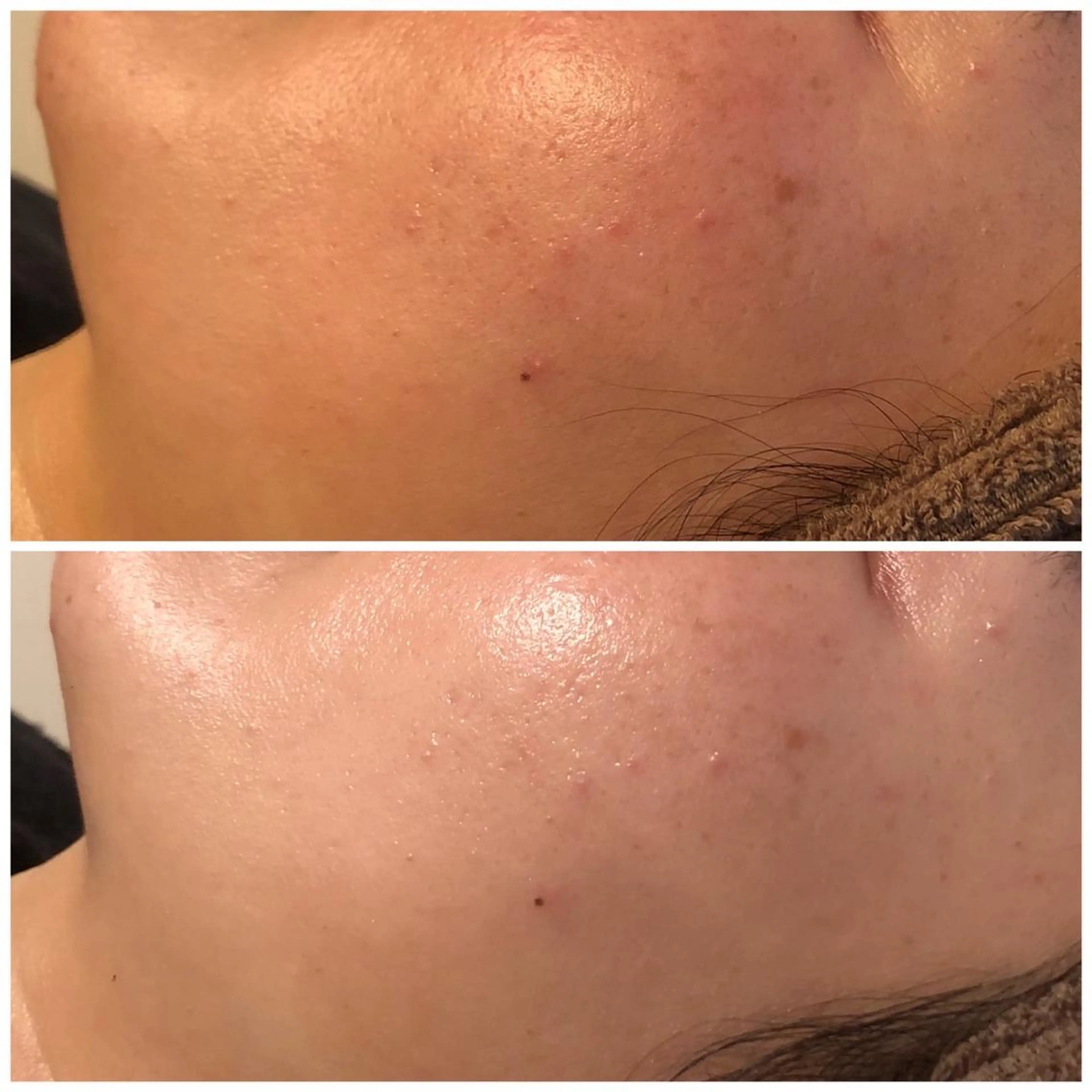 エステ fortune横浜 天王町のその他イメージ