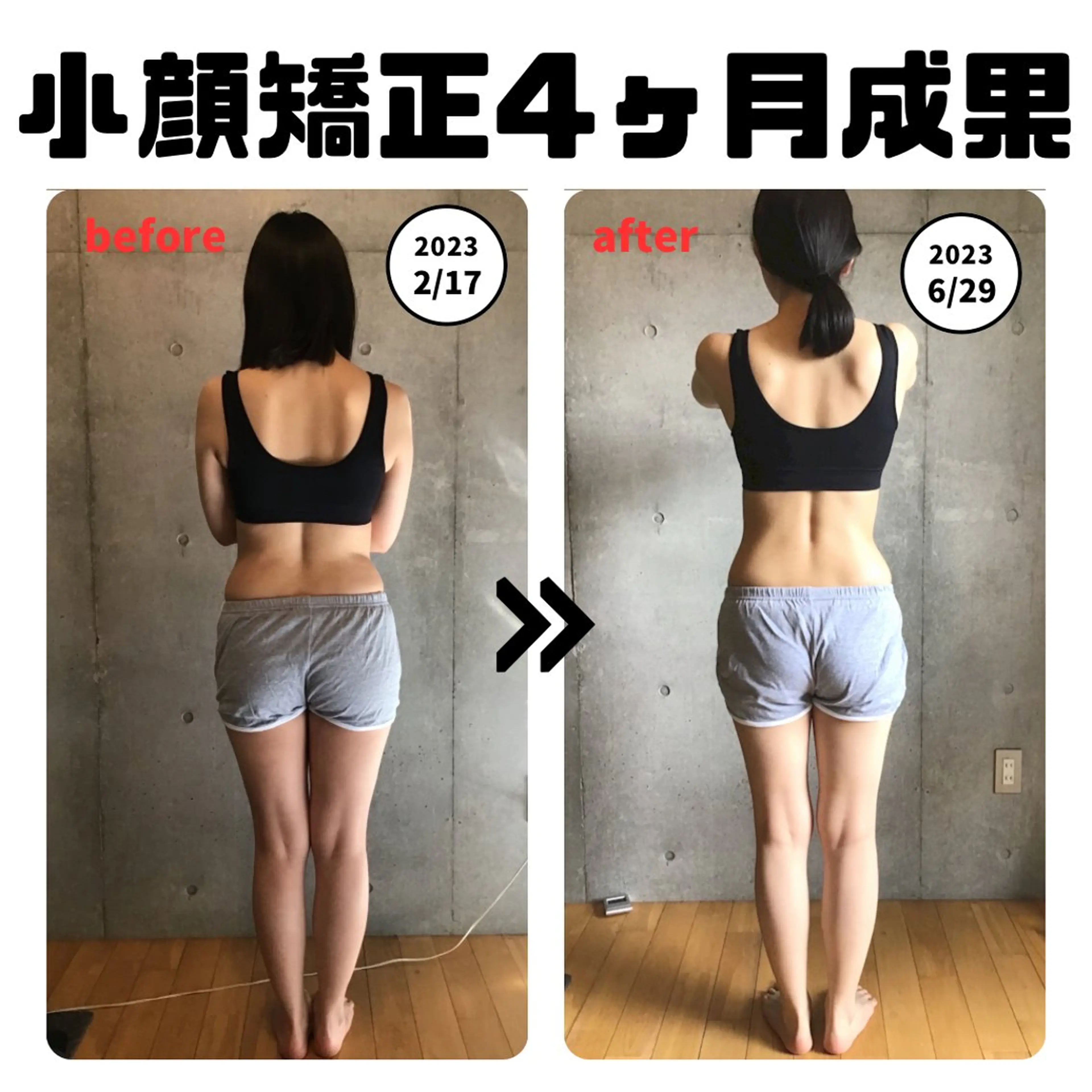 natural所属・natural 小顔・美容矯正〽️のエステ・リラクイメージ