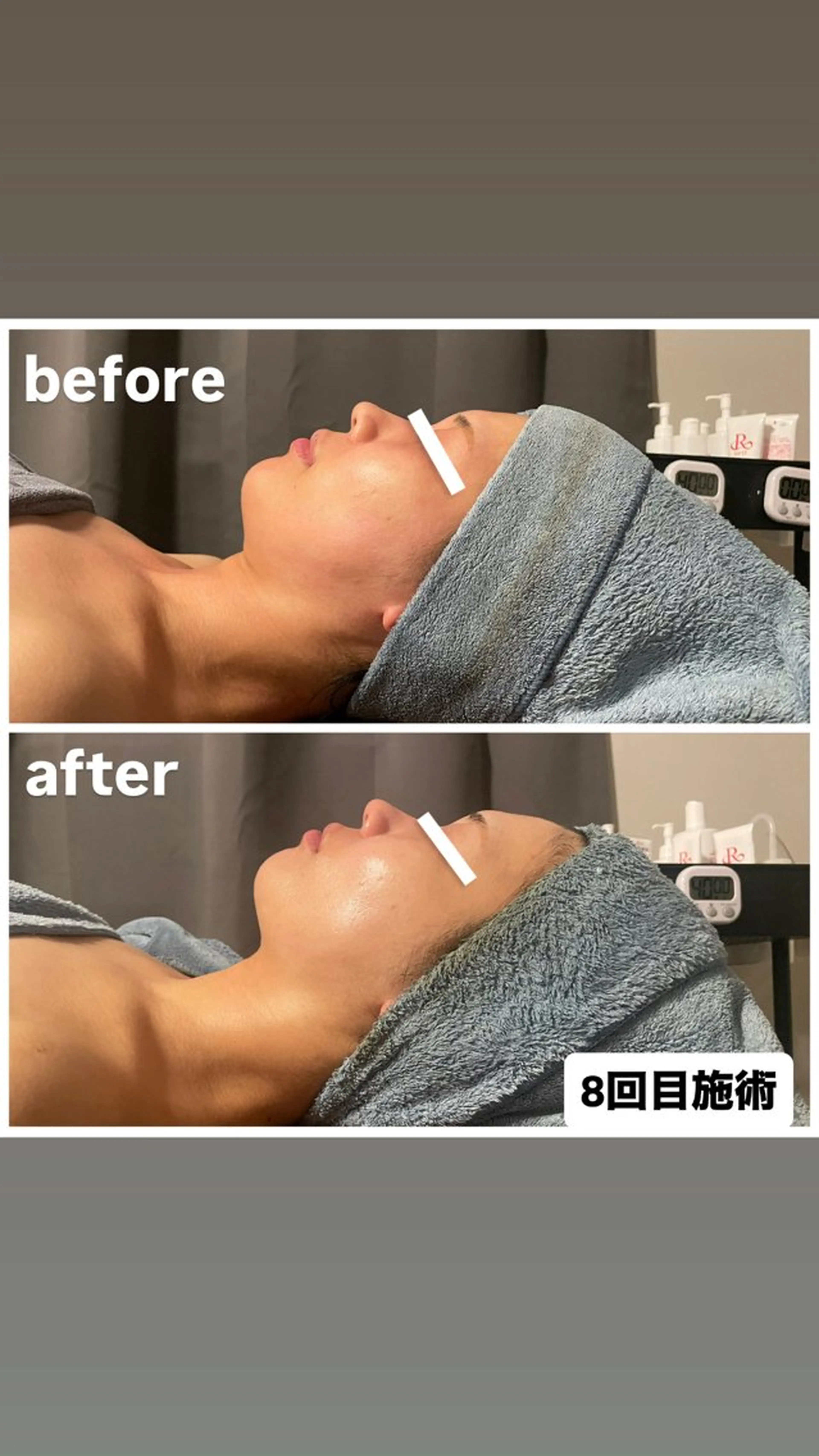 エステ リラク Private Salon77のエステ・リラクイメージ