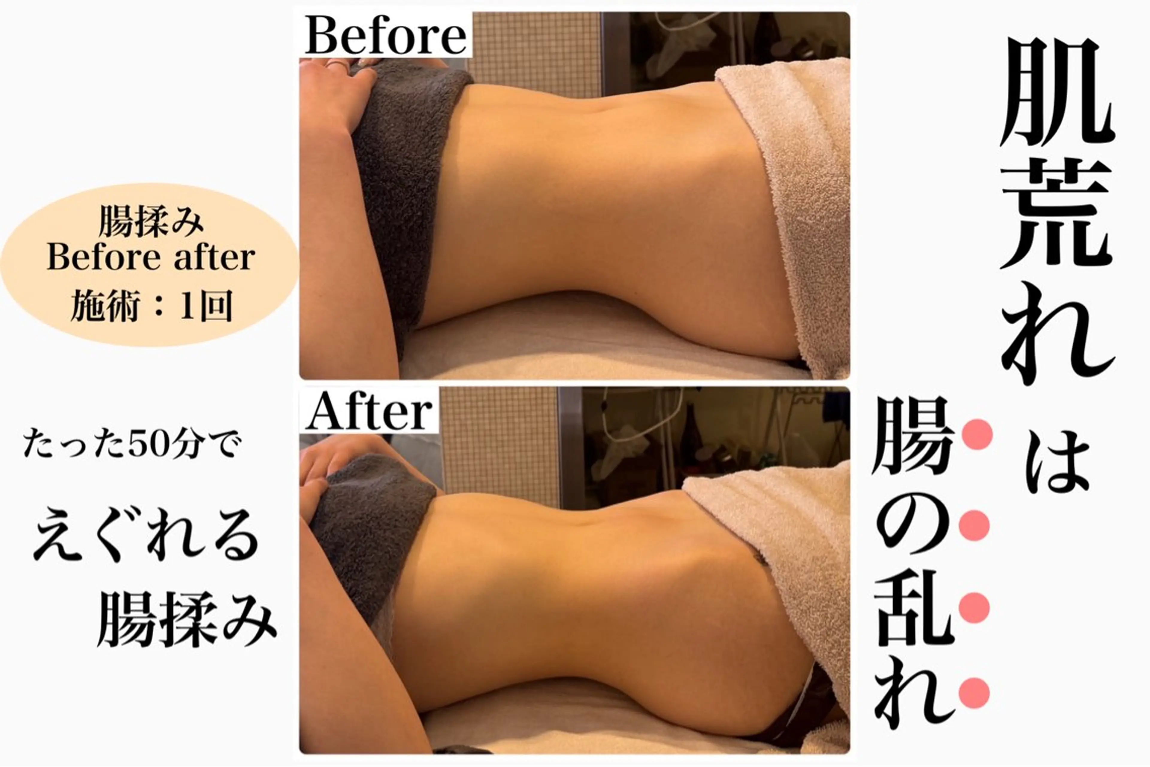 脱毛&フェイシャル 専門店muro.のエステ・リラクイメージ