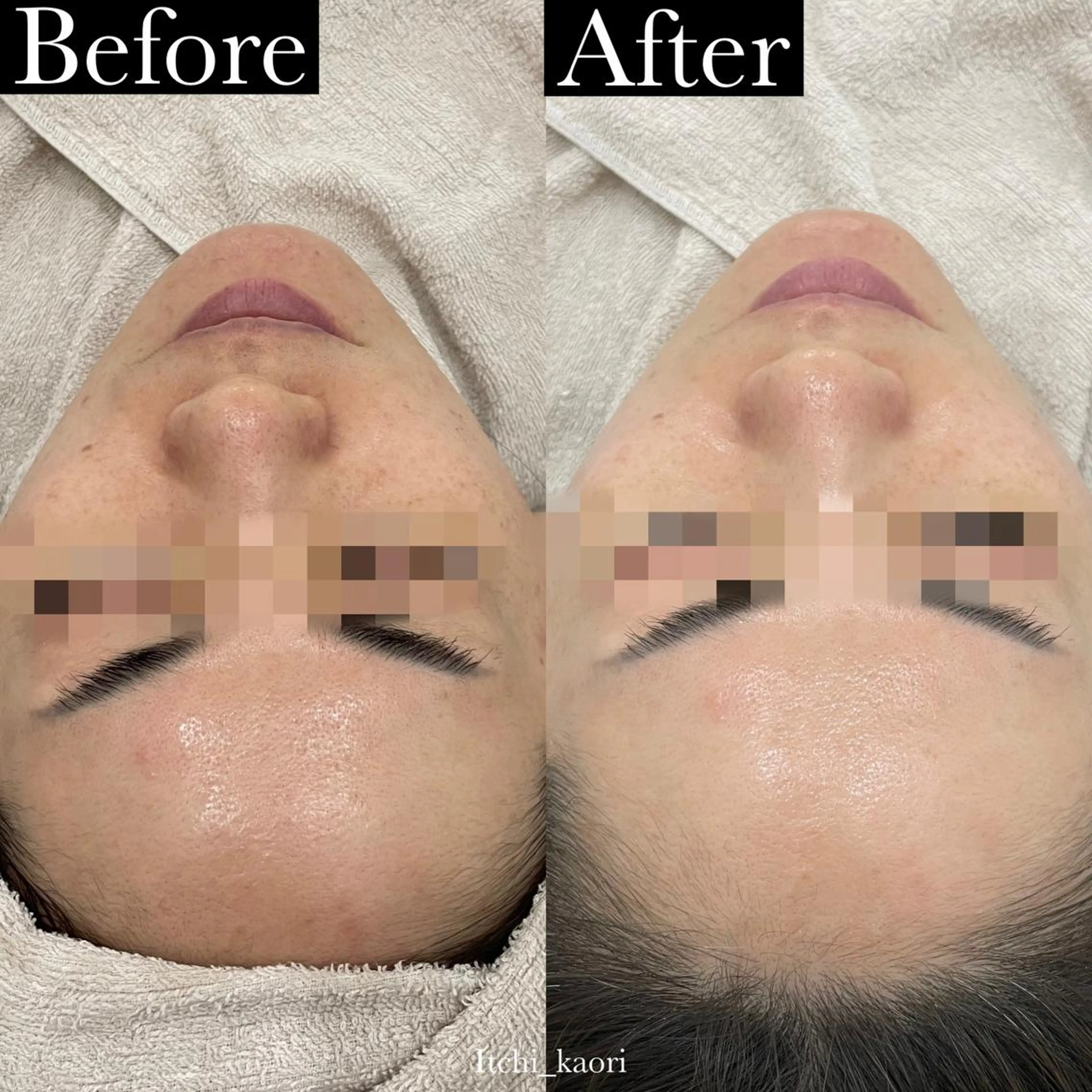 Liself【トリムリターン武蔵小杉・ハーブピーリング】所属・小原 かおりのエステ・リラクイメージ