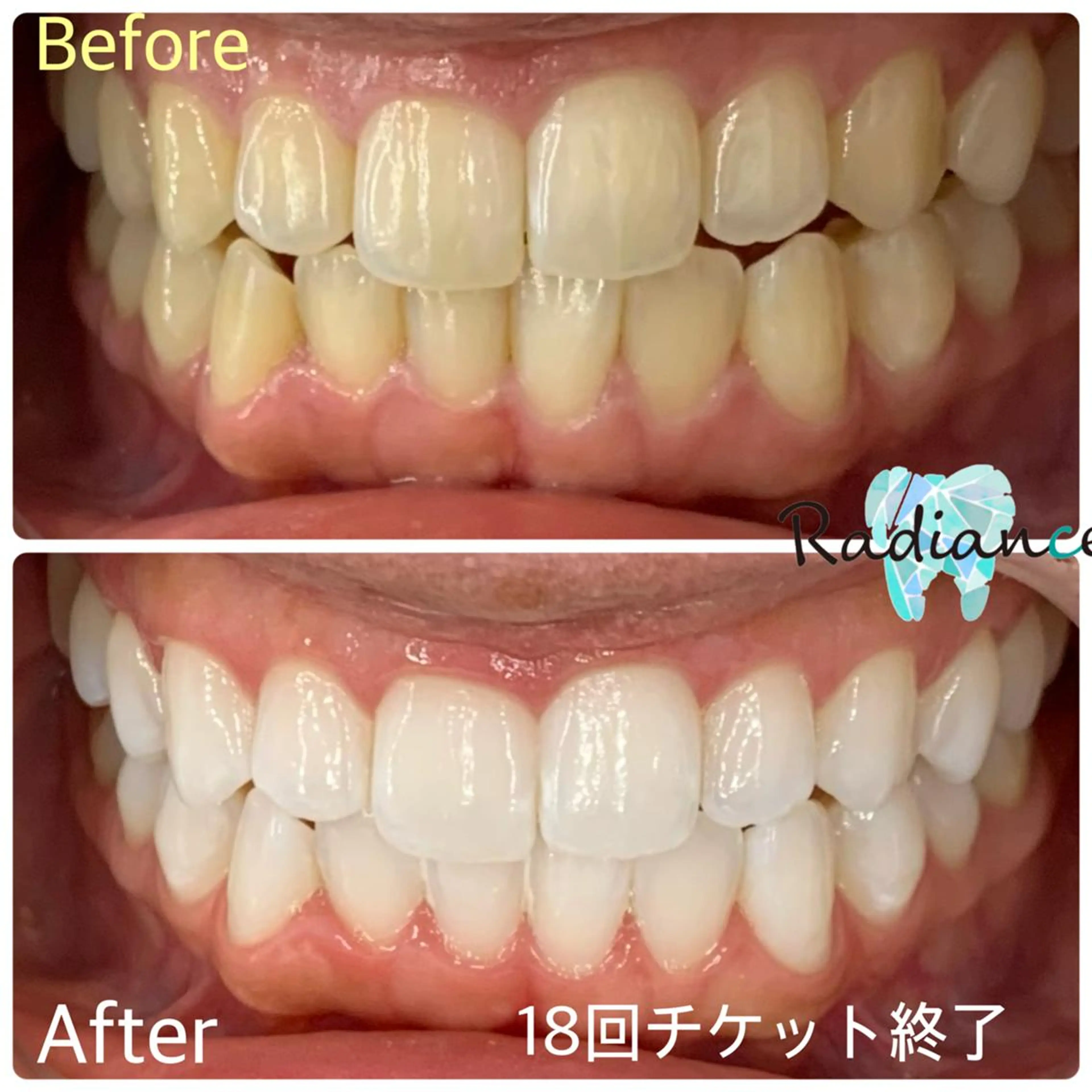 札幌ホワイトニング ラディアンス菊水店のその他イメージ