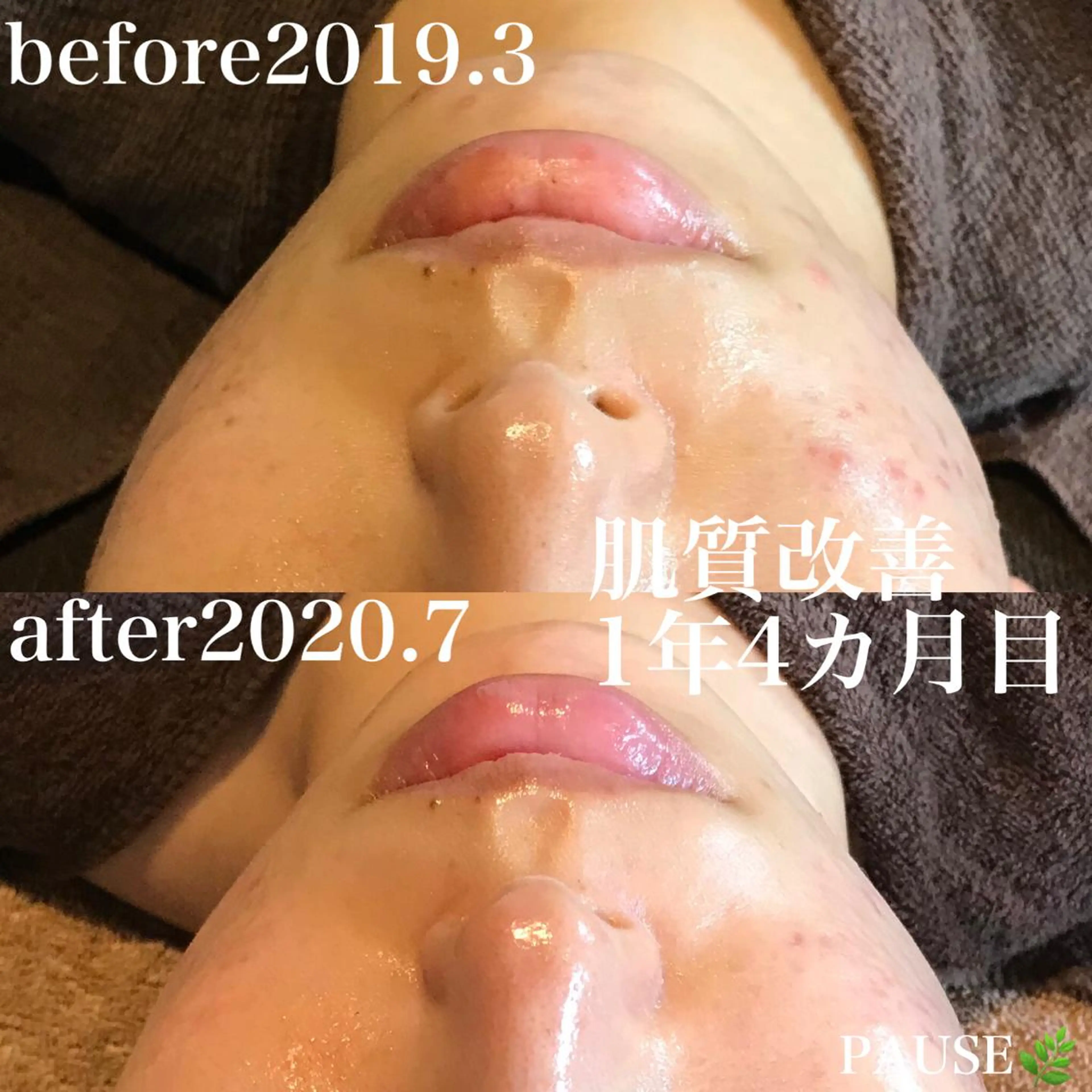 エステ 浜野 恵美のエステ・リラクイメージ