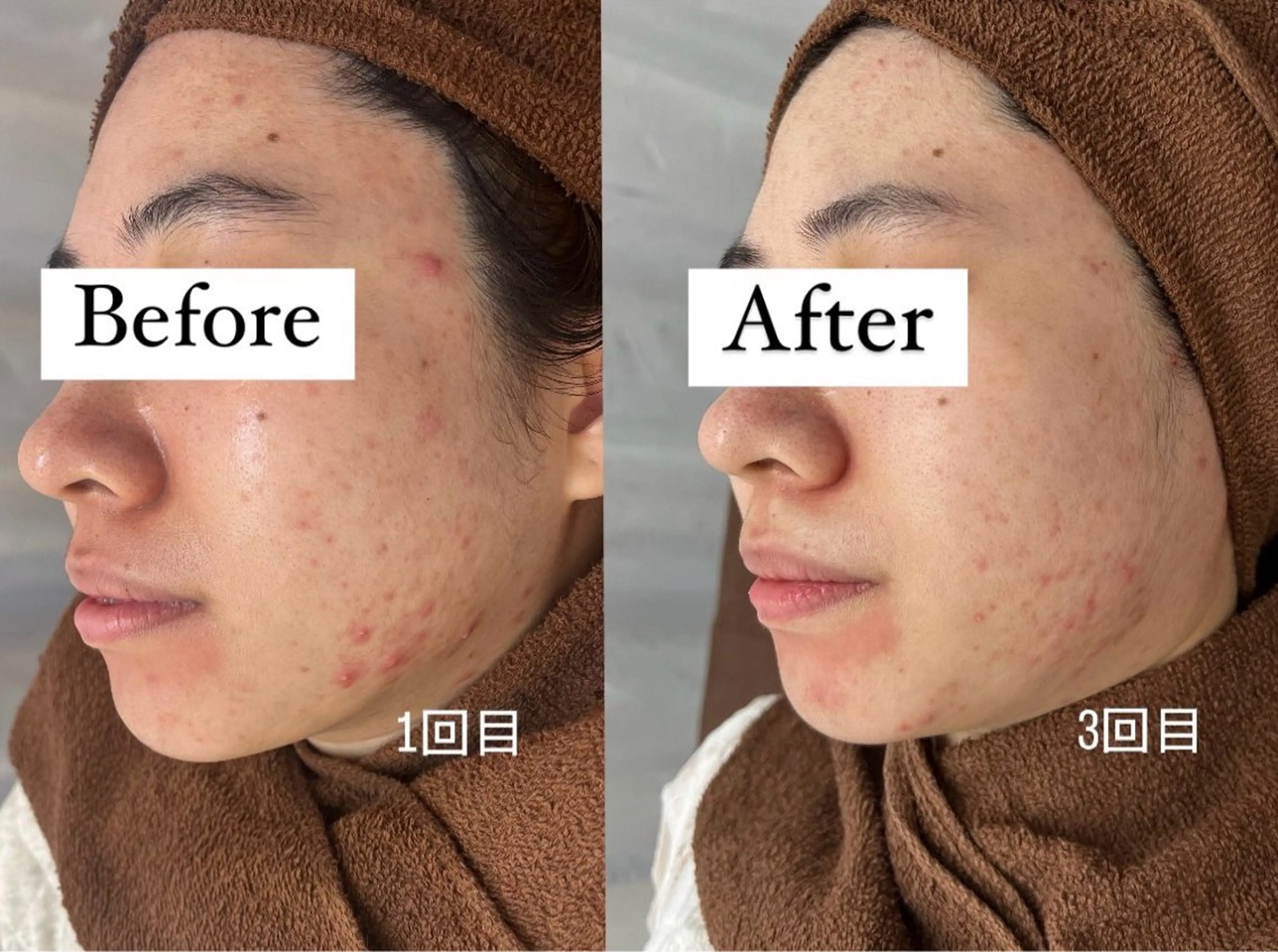 エステ プライベートサロン リプレイスのエステ・リラクイメージ