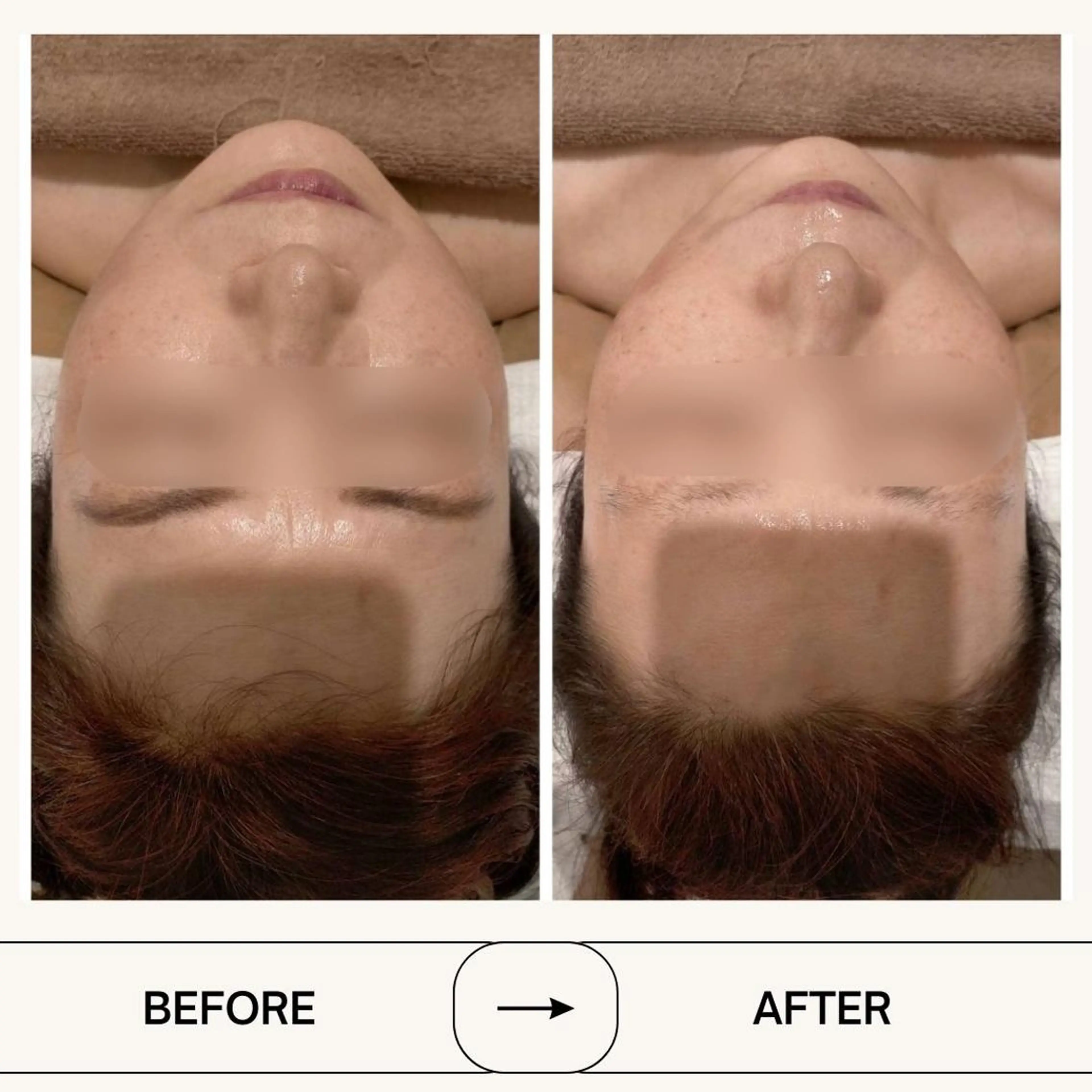 頭蓋骨小顔矯正 ハーブピーリングのエステ・リラクイメージ