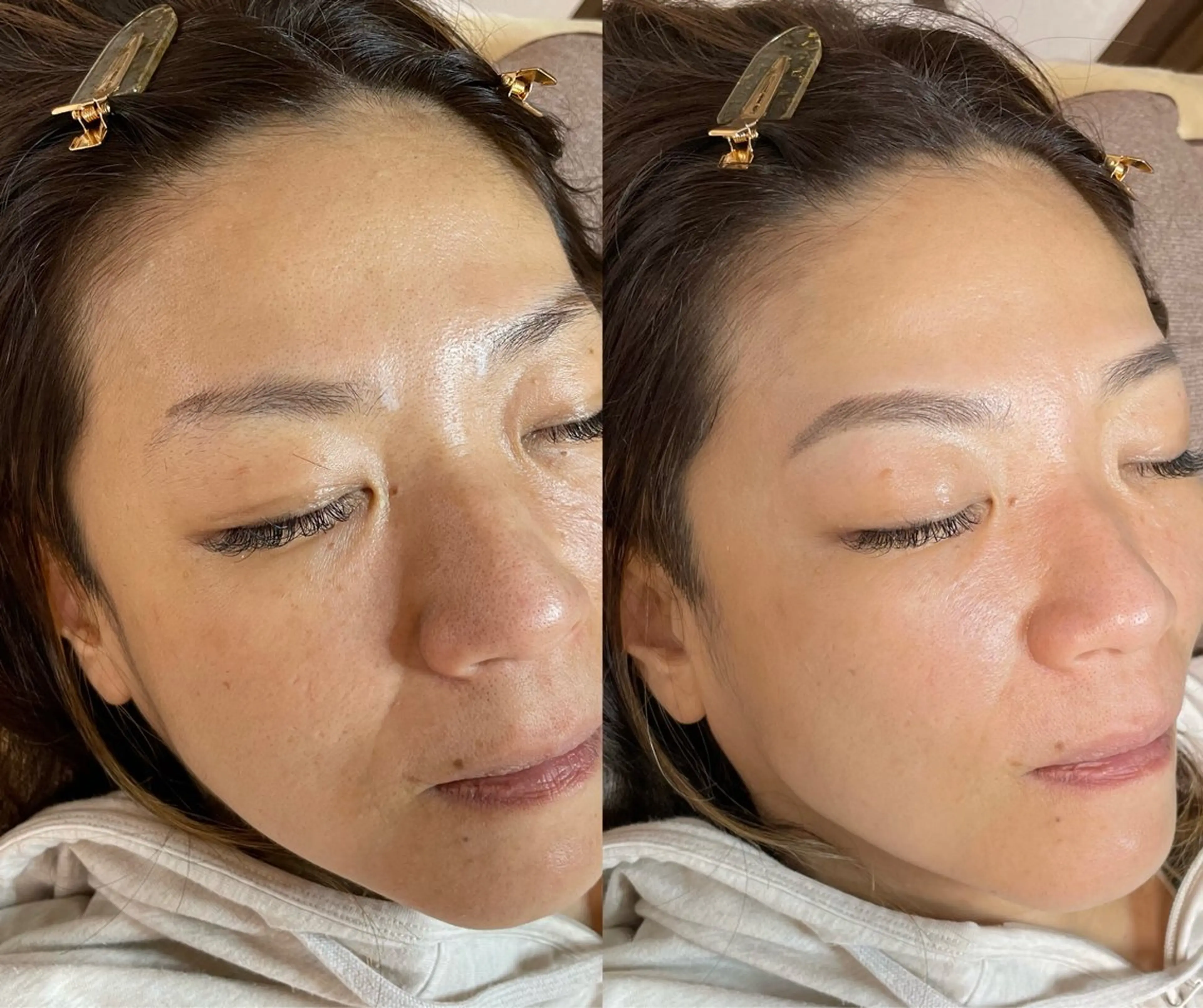 代表 MOMOのエステ・リラクイメージ