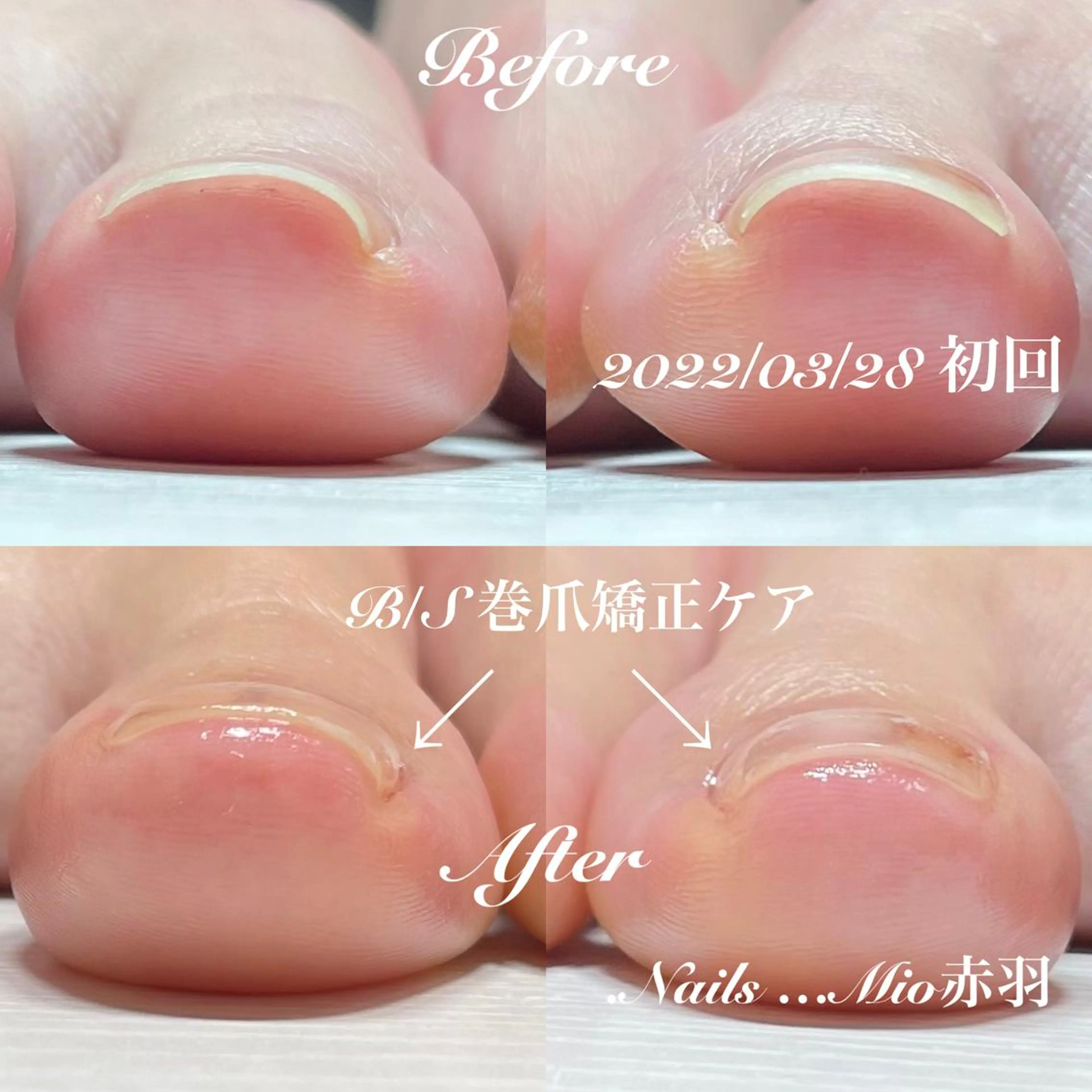 ネイル フットネイル .Nails Mio 赤羽西ネイルサロンのネイルデザイン