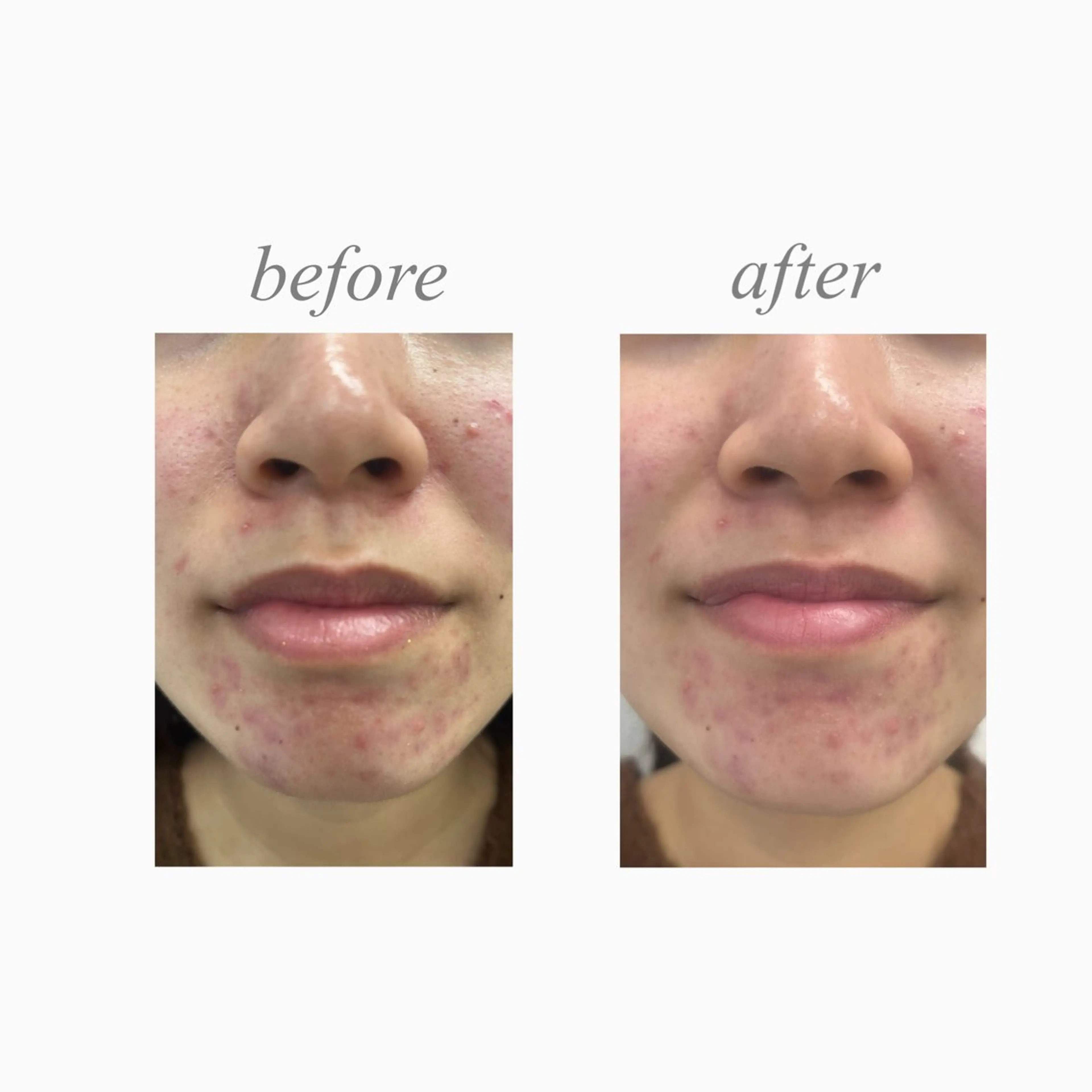 Aspility /天文館のエステ・リラクイメージ