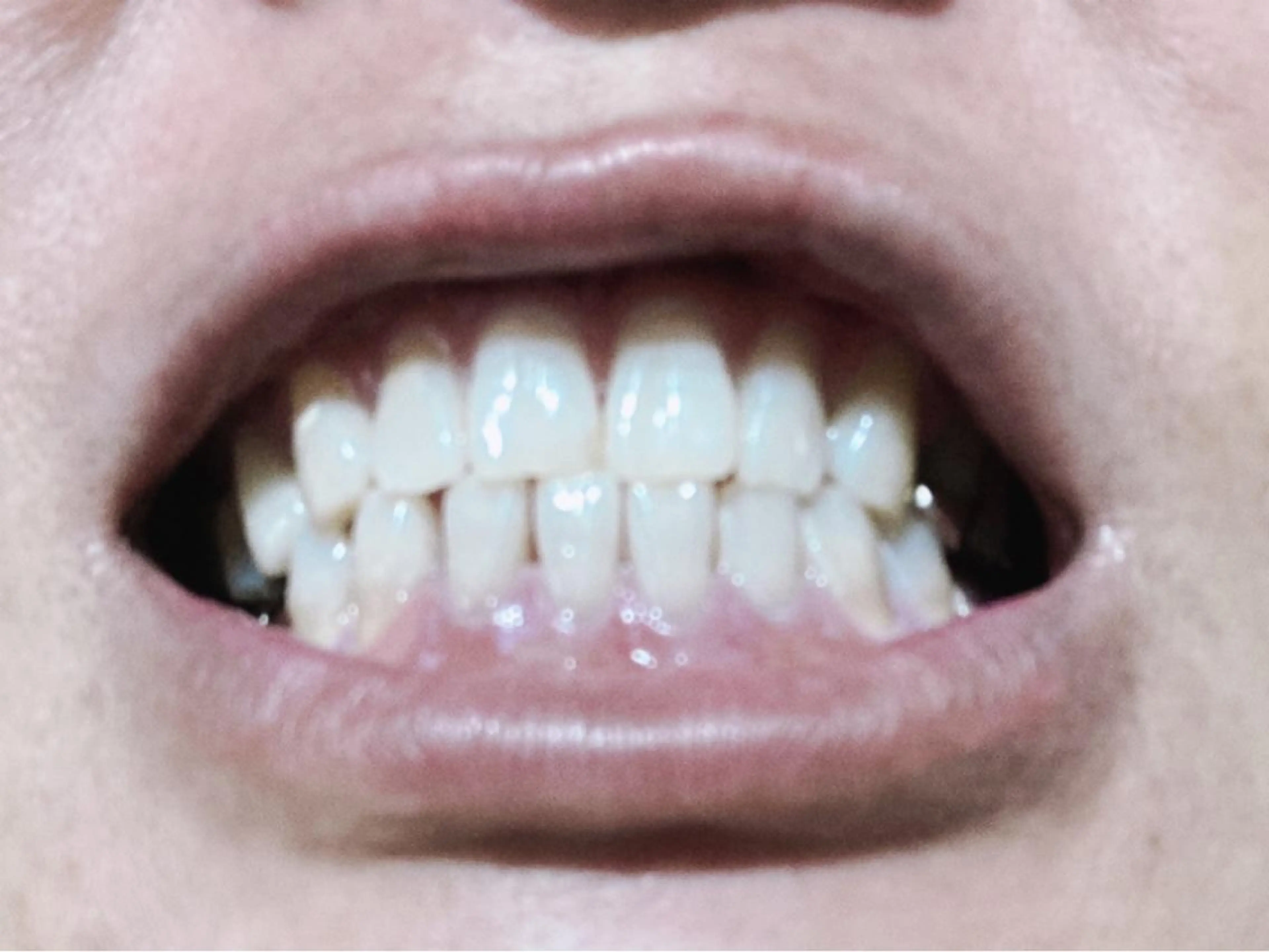 エステ リラク ホワイトニングジム 池袋のその他イメージ