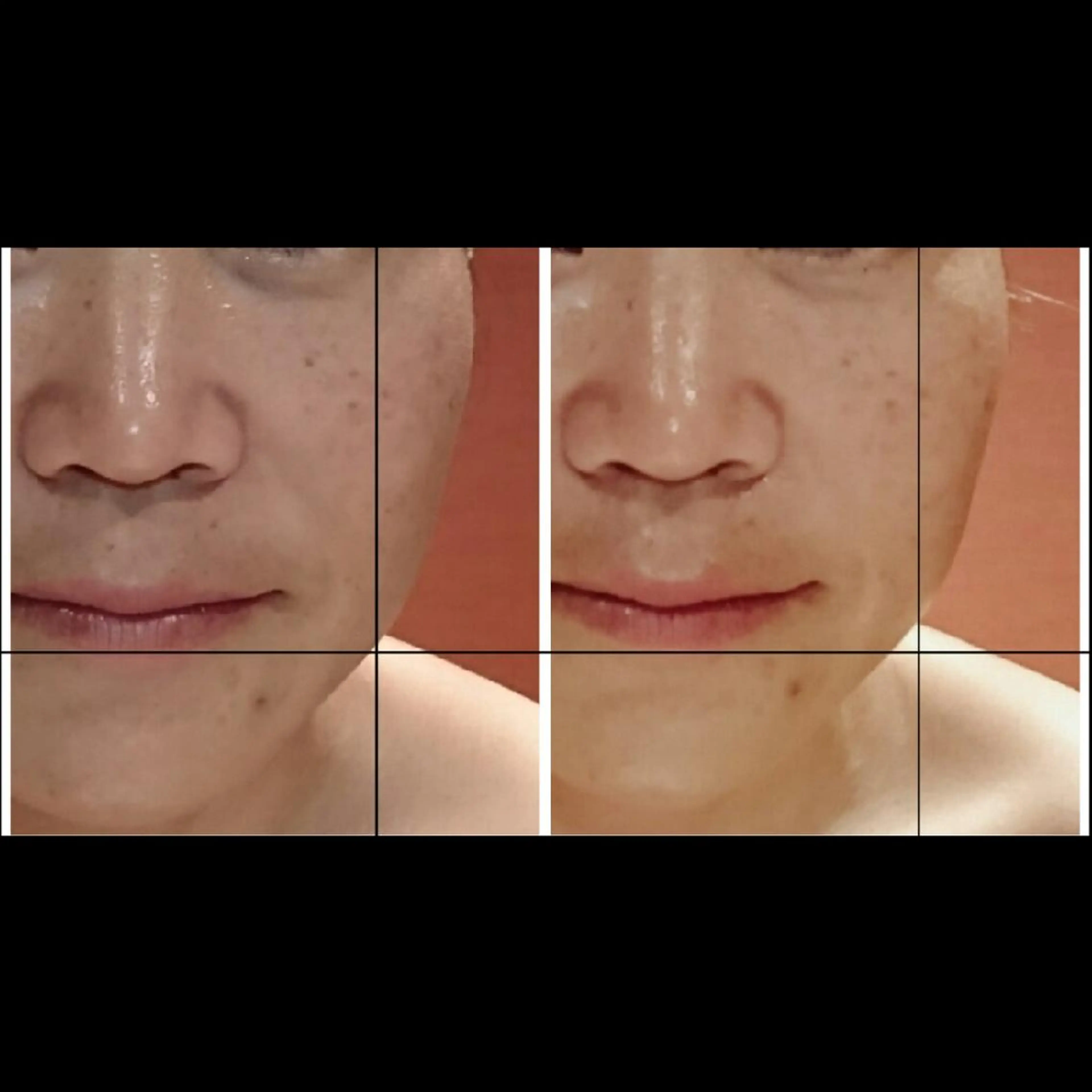 エステ リラク Nako ナコのエステ・リラクイメージ