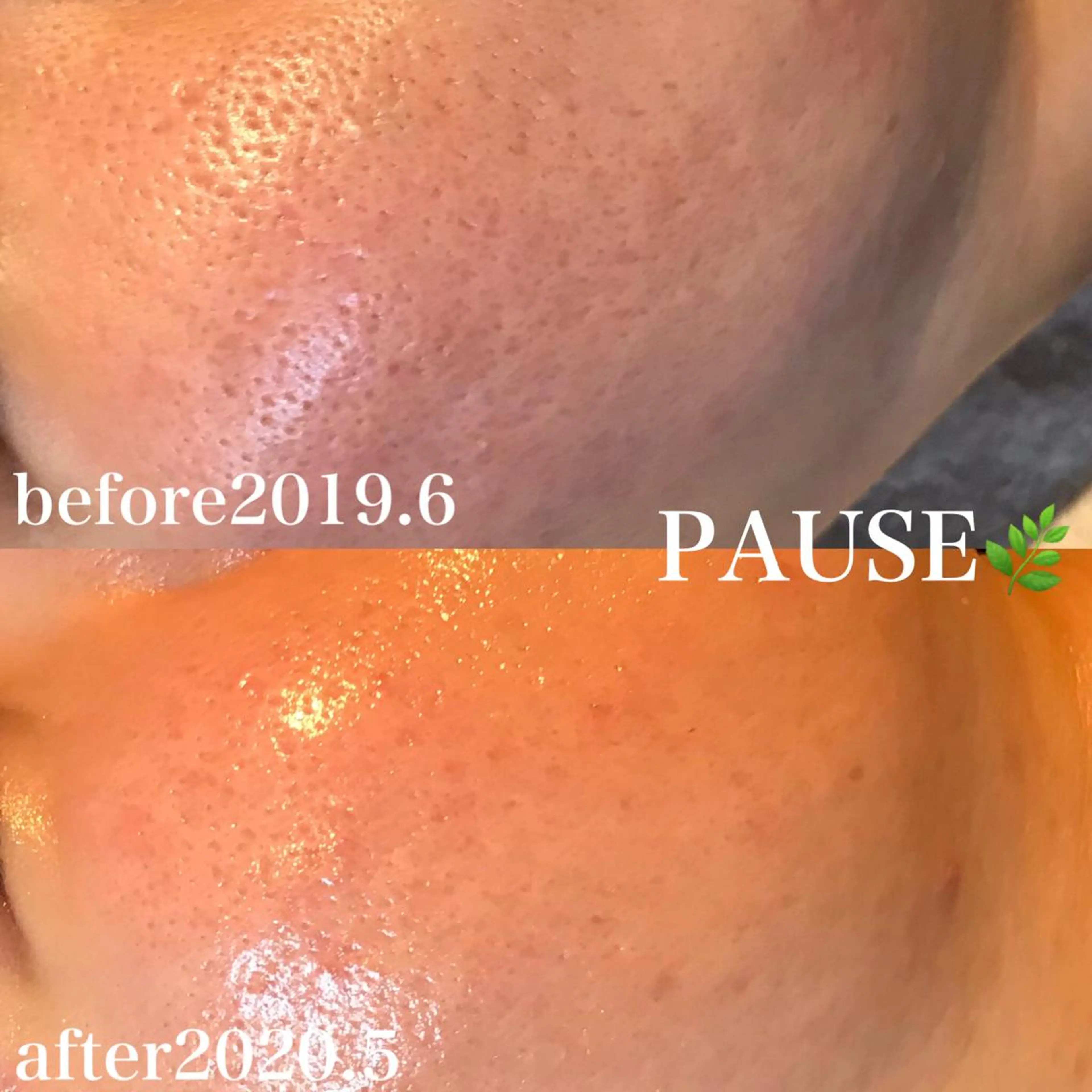 エステ 浜野 恵美のエステ・リラクイメージ