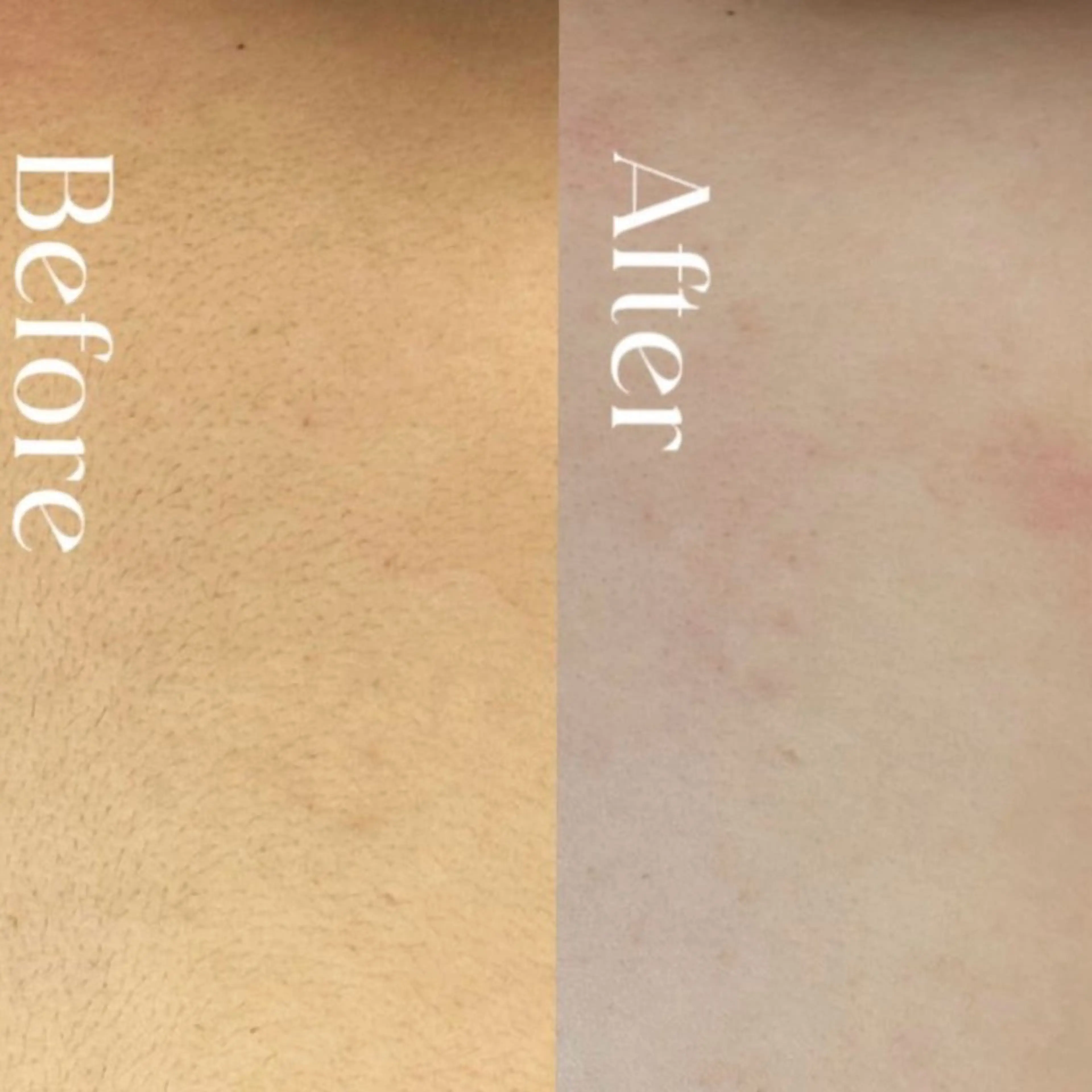 Hitomi シュガーリング豊橋のその他イメージ