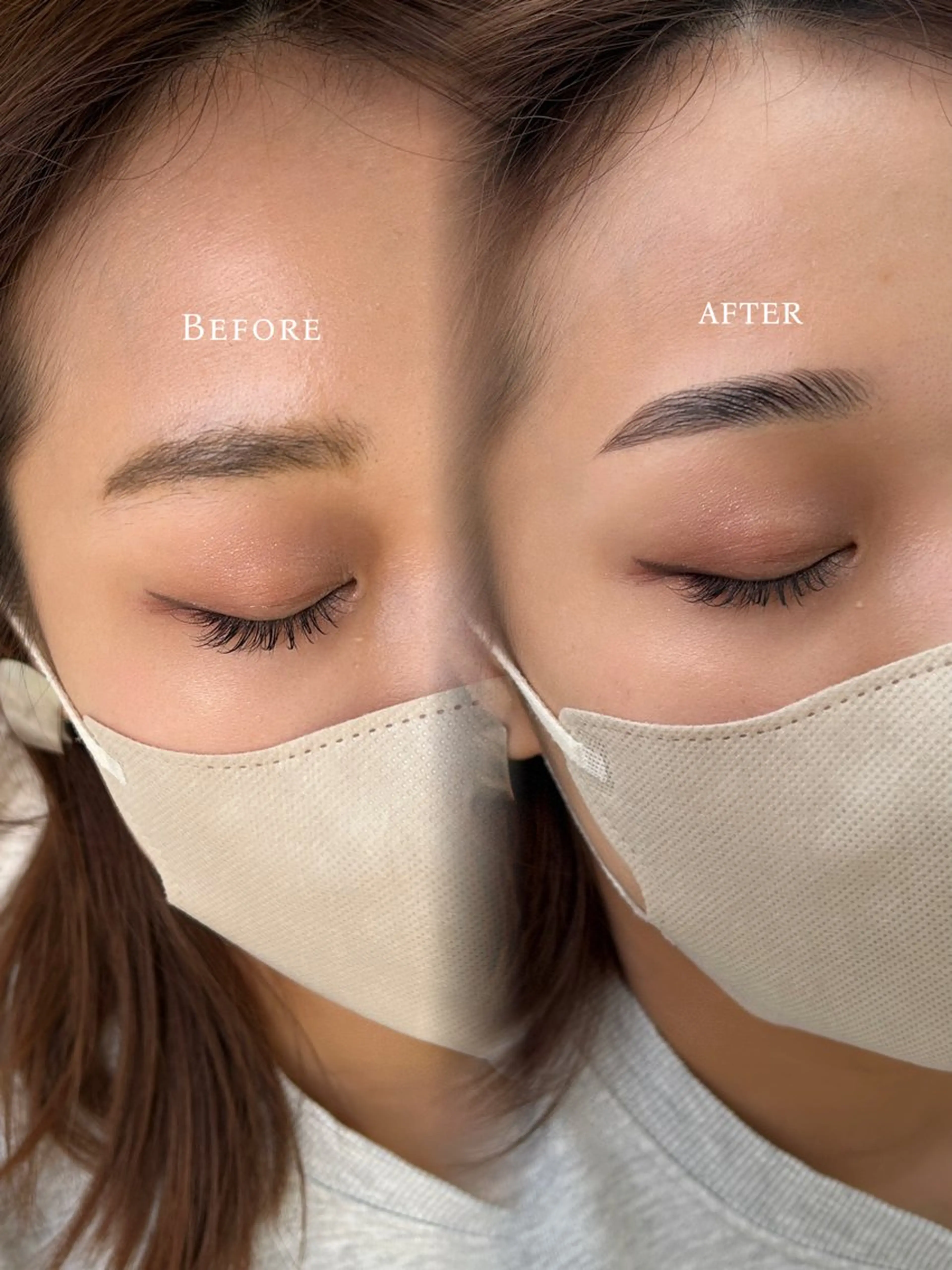 ブロウリフトの写真