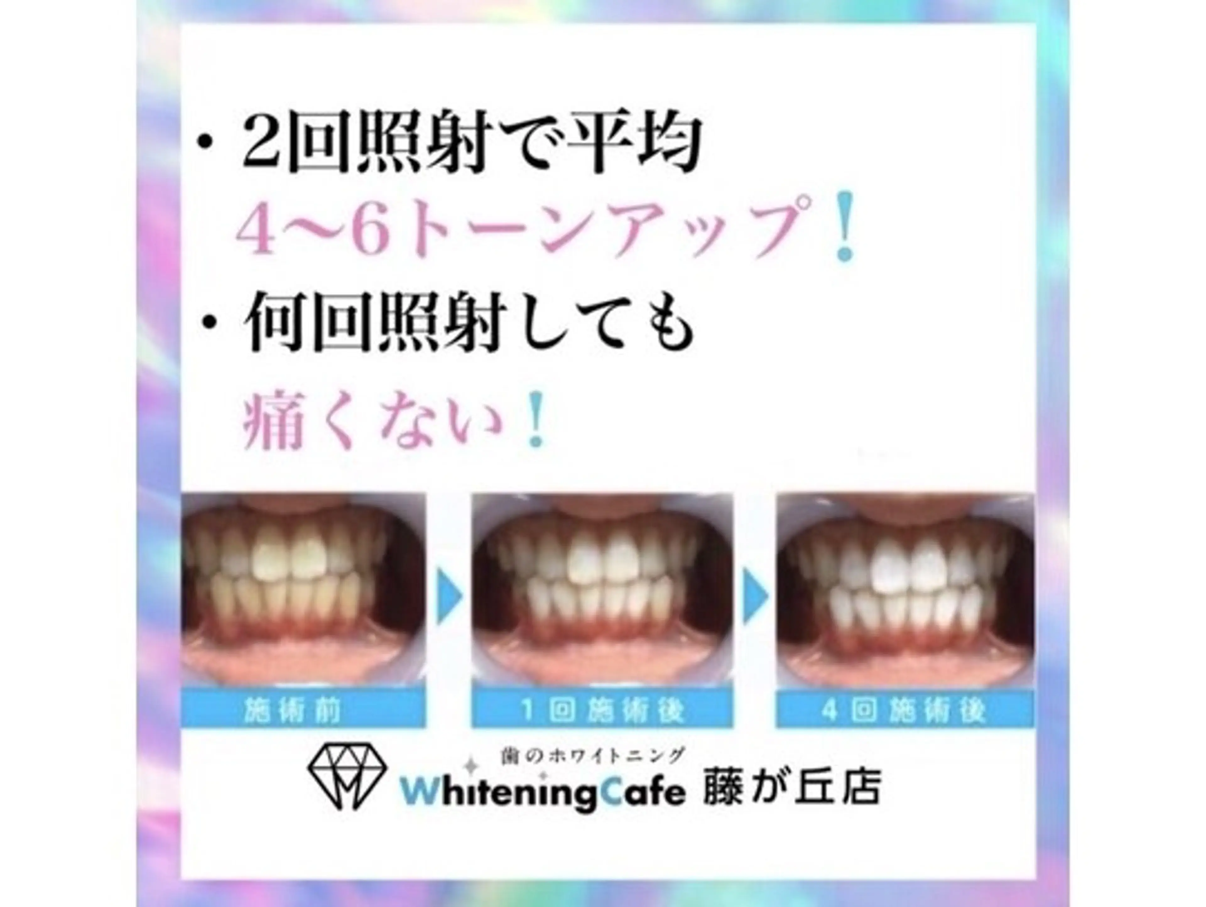 メンズ ホワイトニングカフェ 藤が丘のその他イメージ