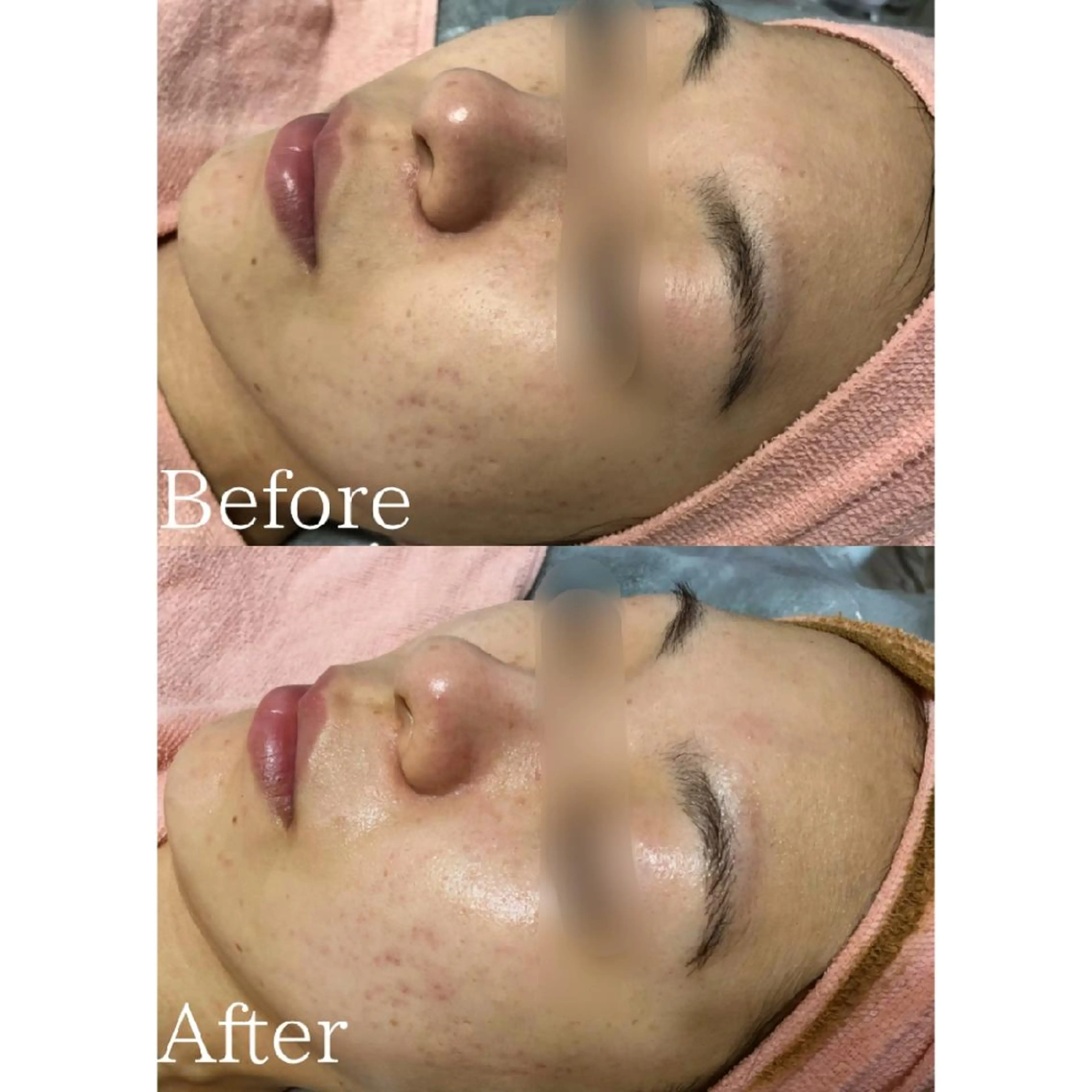 エステ 肌質改善サロン BestBelleのエステ・リラクイメージ