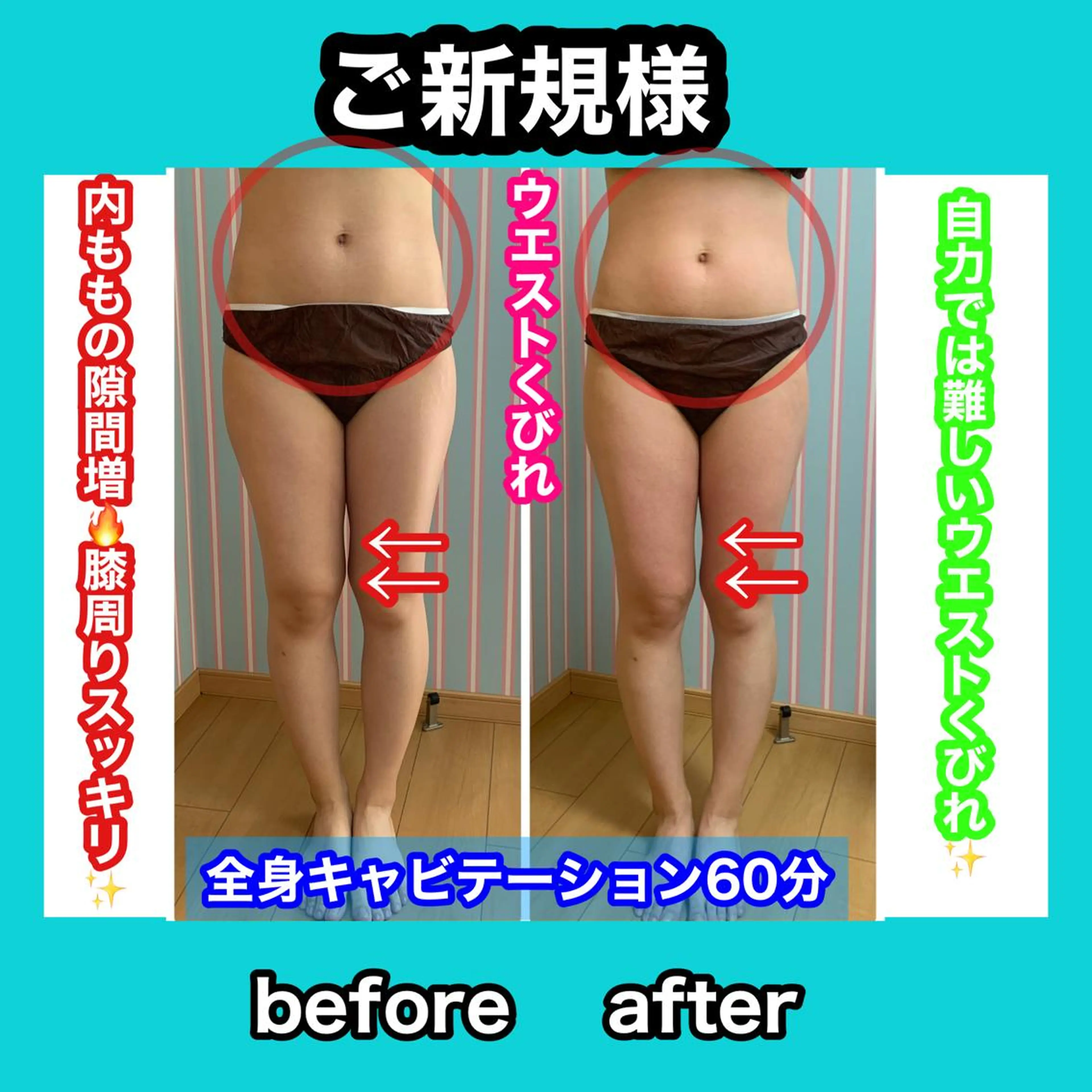 エステ リラク 痩身/脱毛/ネイル HARUKAのエステ・リラクイメージ