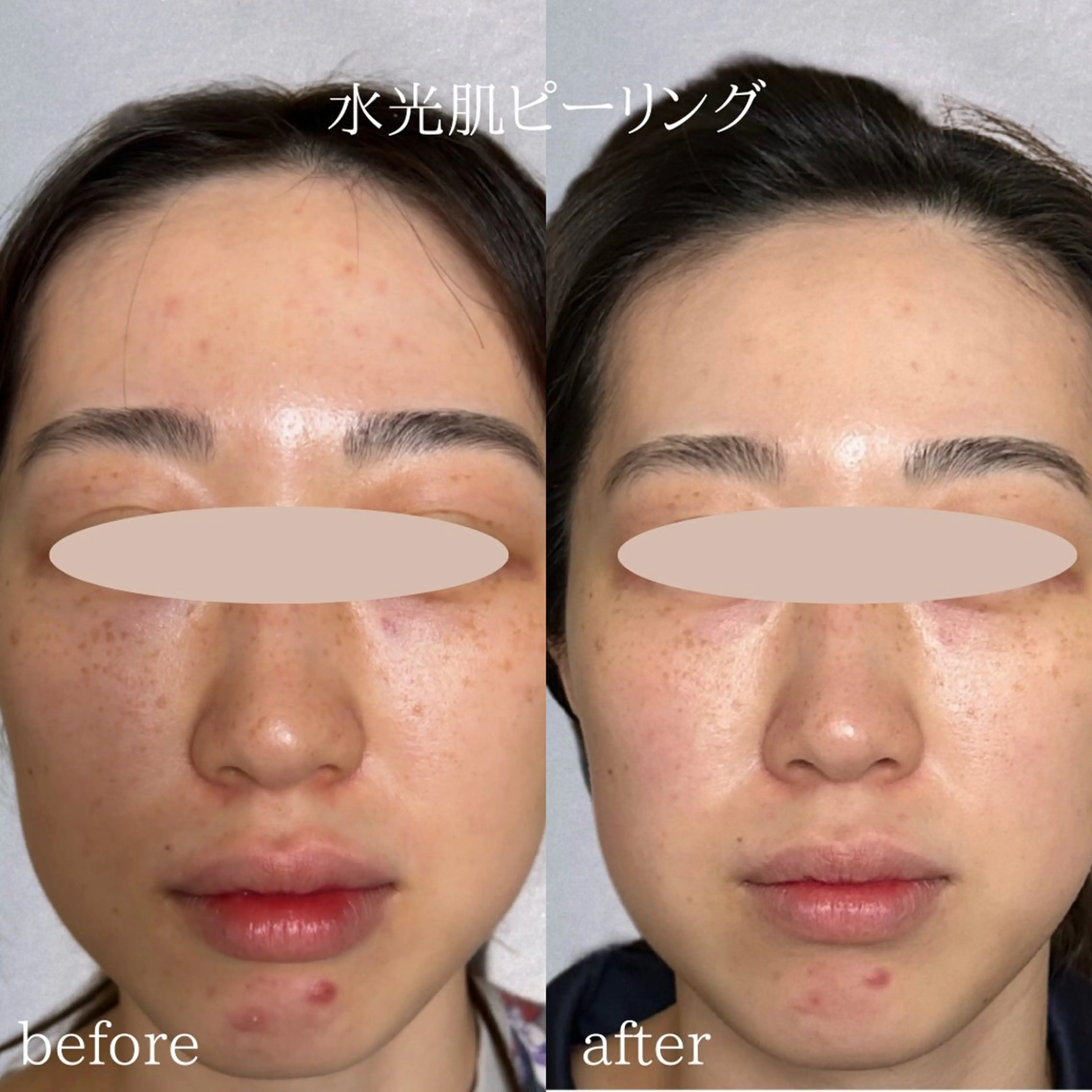 美腸サロン🌺 腸もみ/小顔/リンパのエステ・リラクイメージ