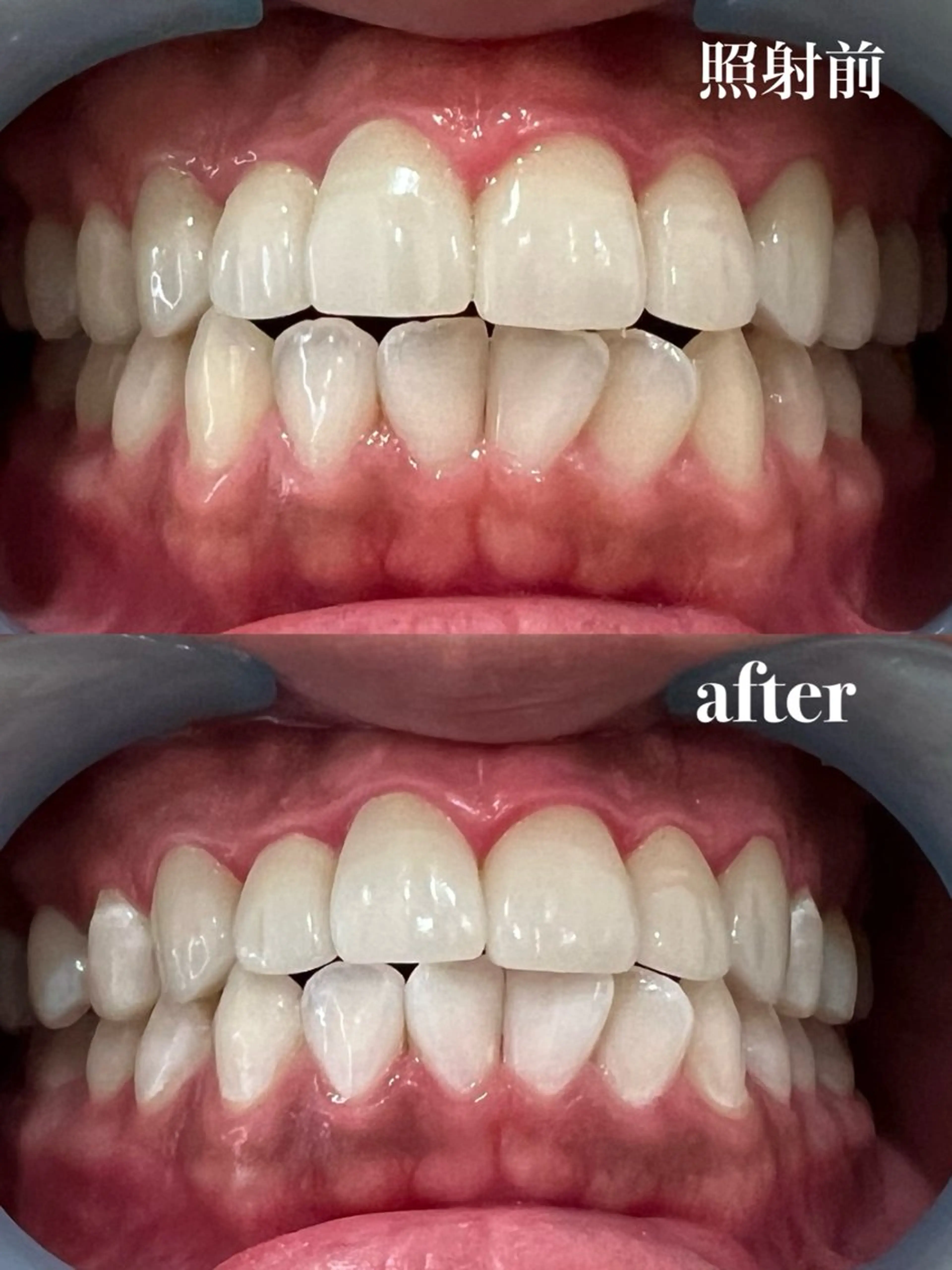 その他 𝐑𝐞𝐯𝐢𝐨 ___堺市西区のマツエク・マツパデザイン