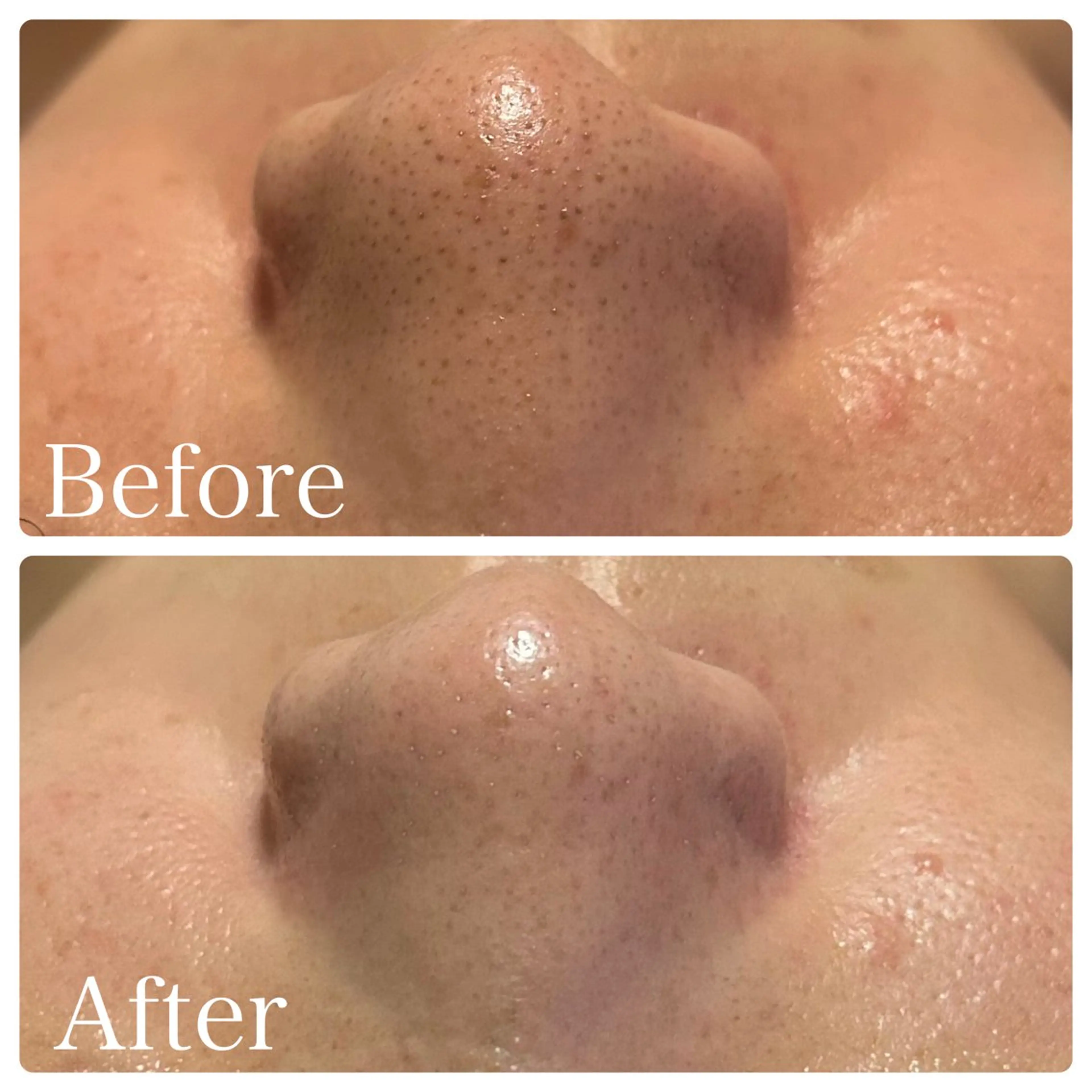 エステ リラク 🌴Beauty Salon LANAのエステ・リラクイメージ