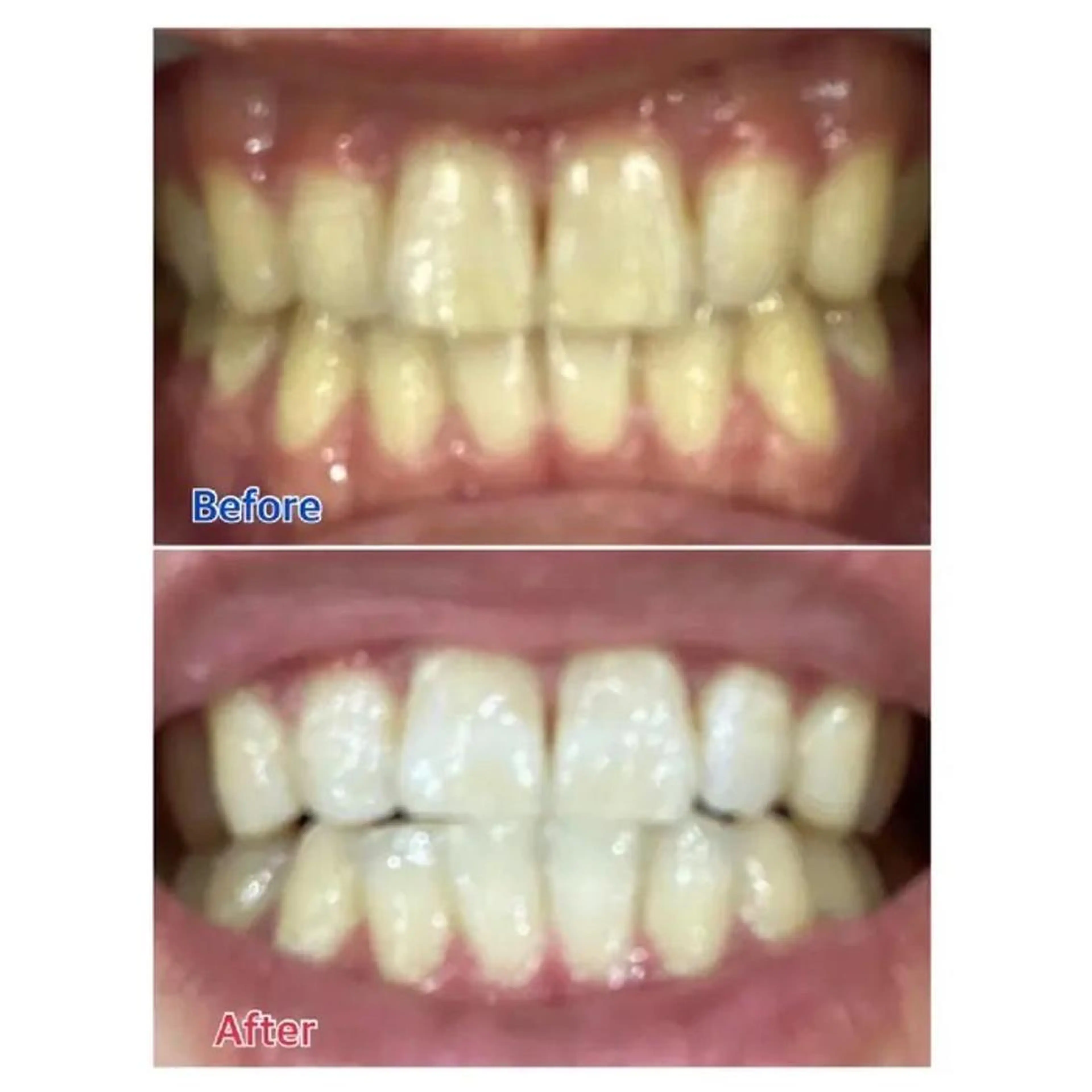 M渋谷 ホワイトニングのエステ・リラクイメージ