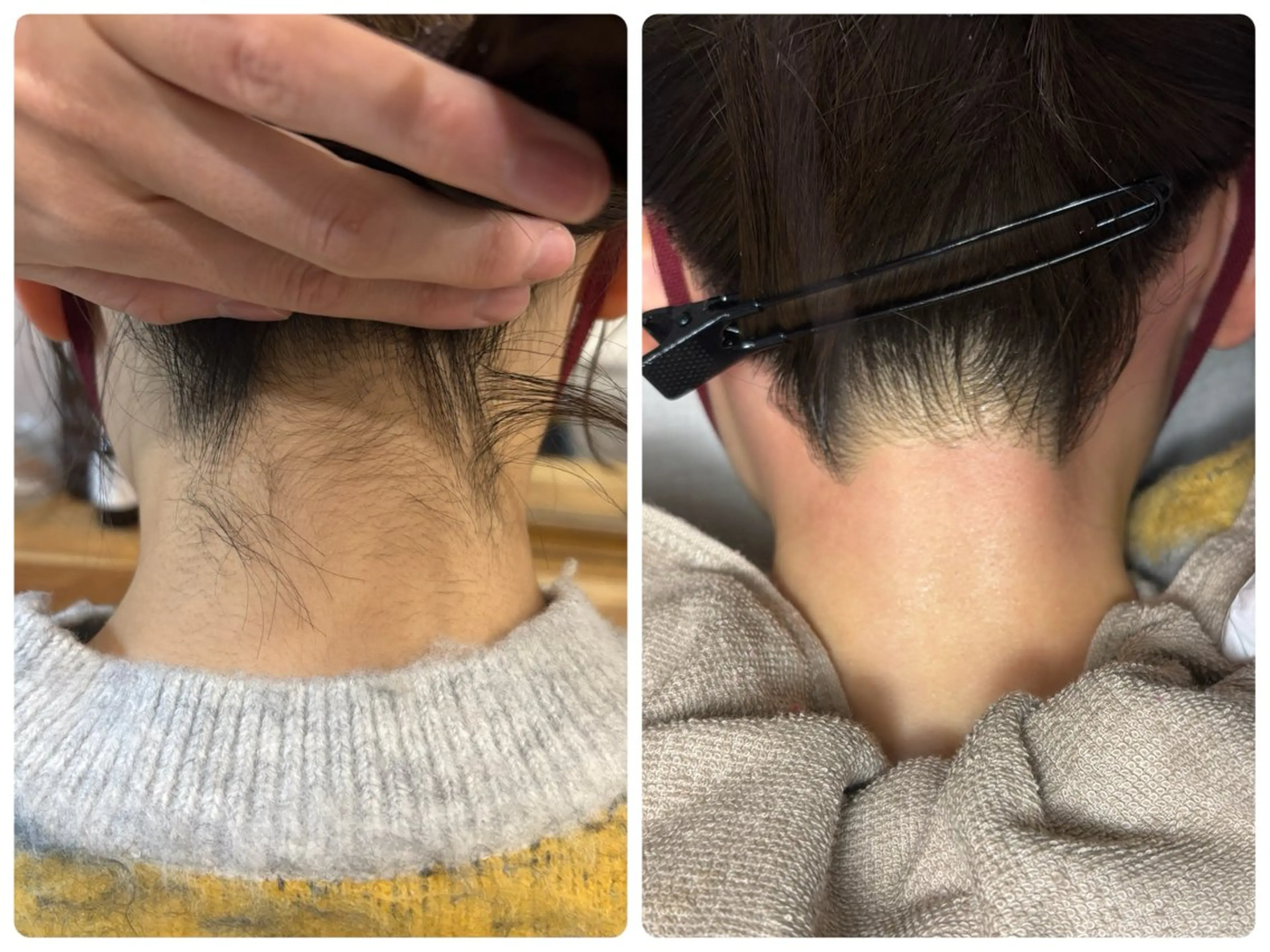 脱毛 any ［Hata Aya］のエステ・リラクイメージ