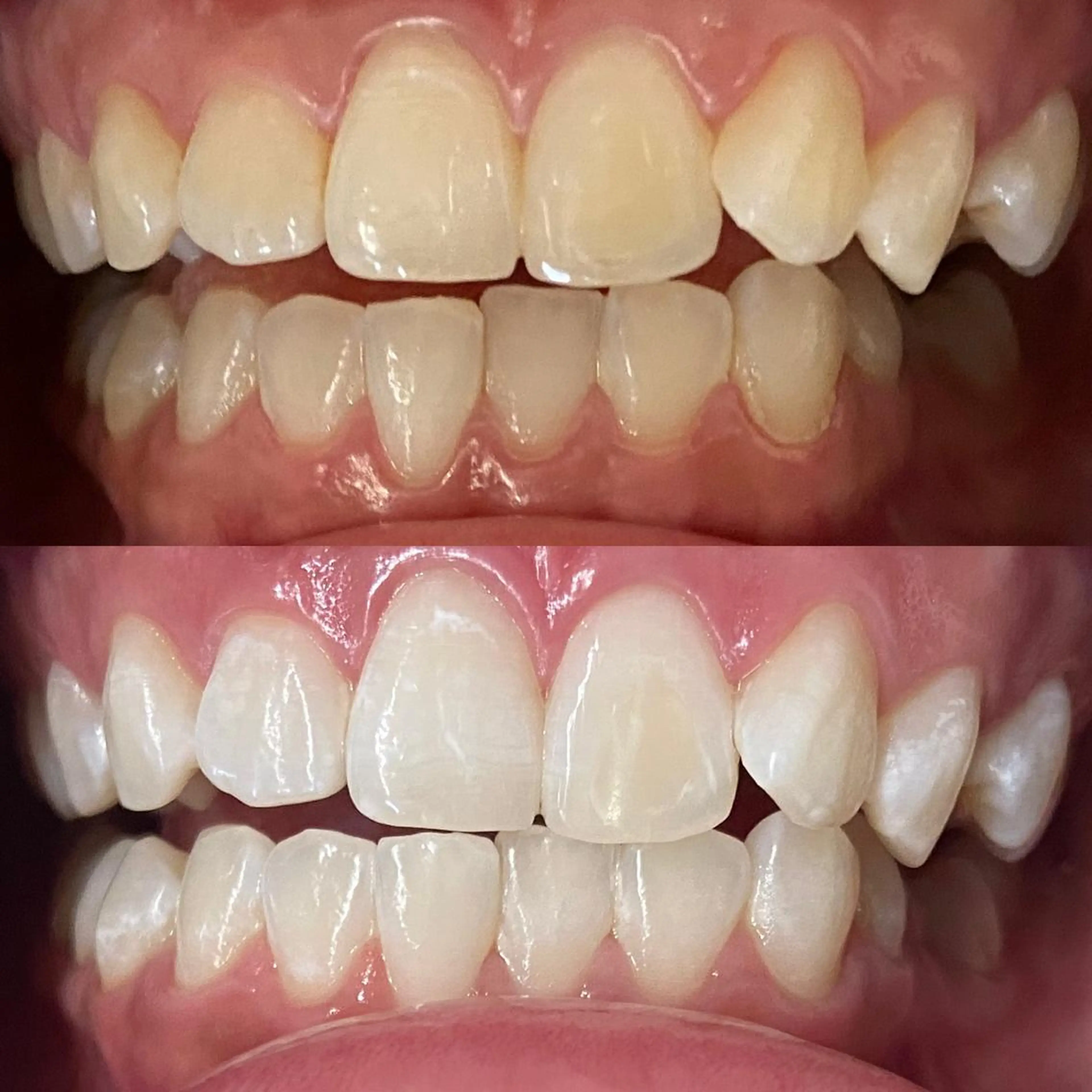 マツエク・マツパ その他 ホワイトニングサロン CREWのその他イメージ