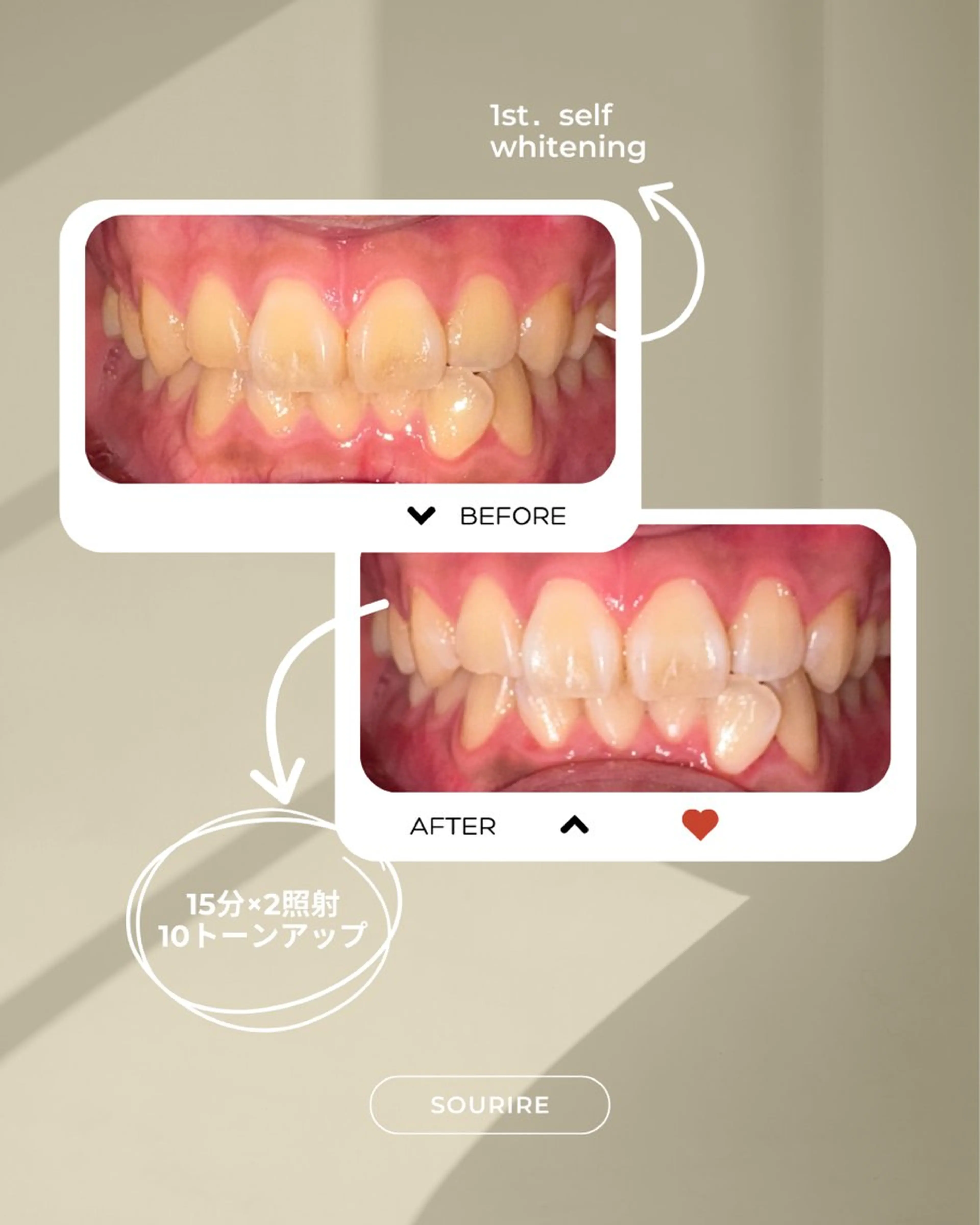 加藤 愛菜のその他イメージ