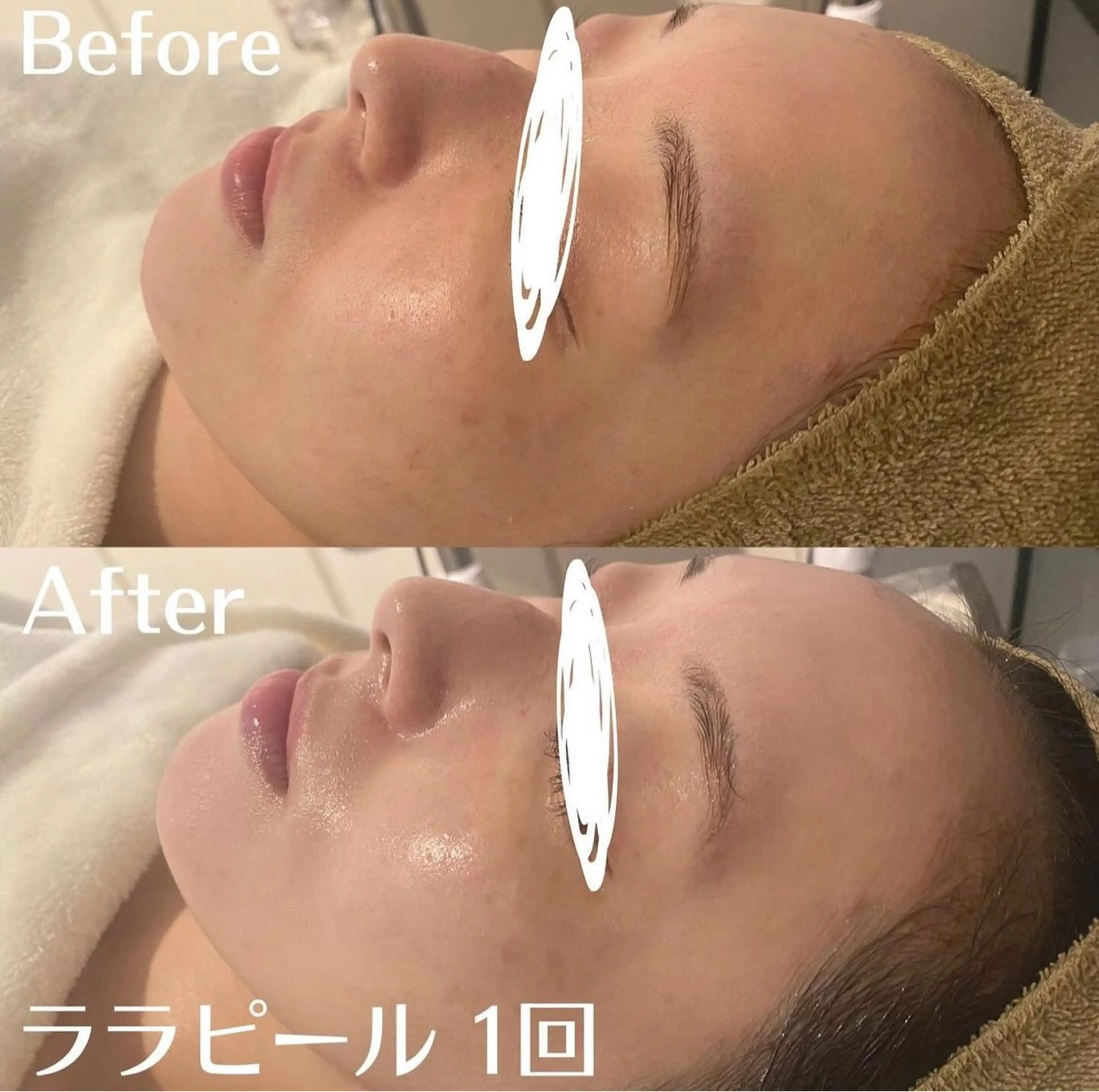 中目黒ハーブピーリン グ🌿ララピールのエステ・リラクイメージ