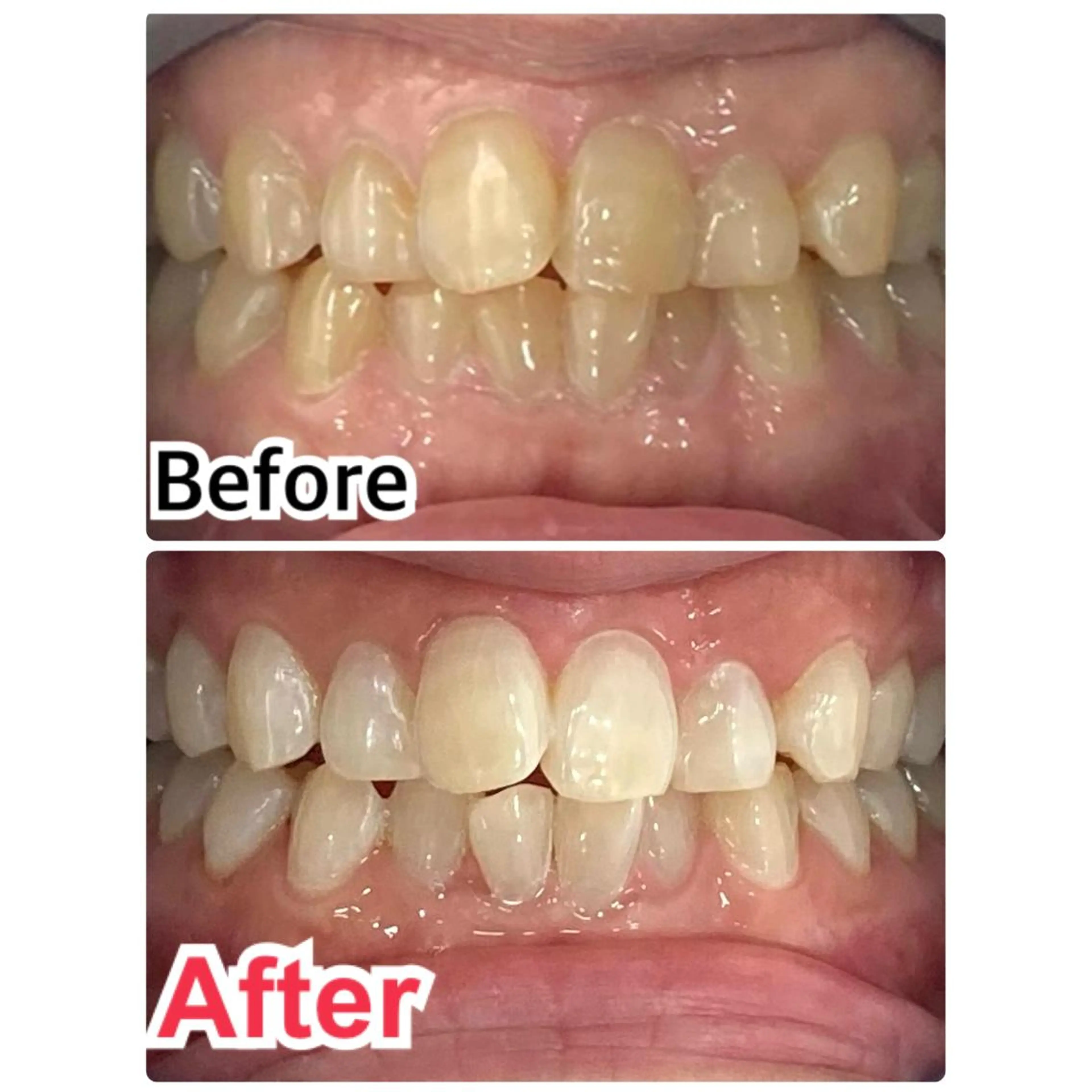 【歯科提携】柏ホワイ トニングスタイルのその他イメージ