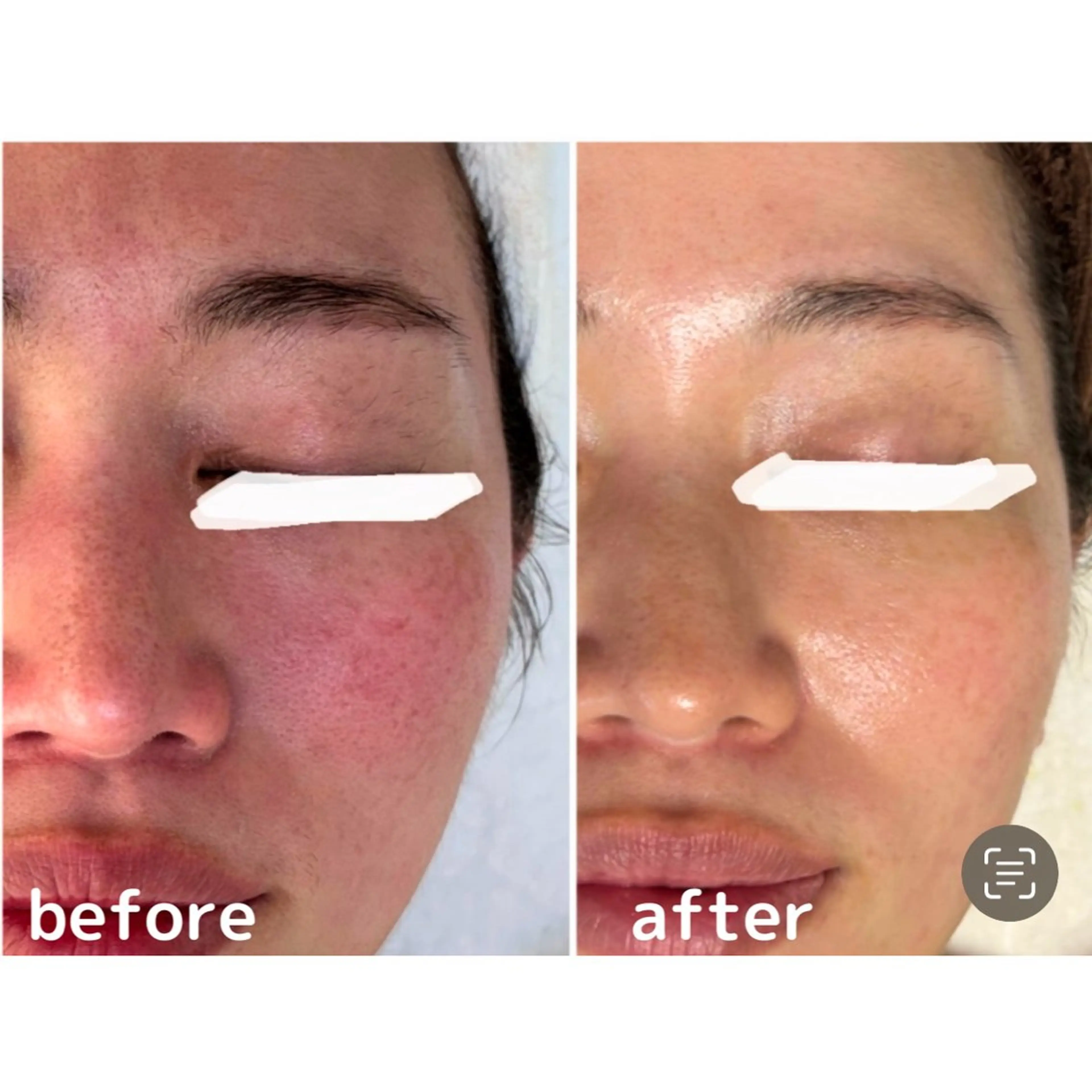 エステ 肌質ケアFor... 天王寺店 みほのエステ・リラクイメージ