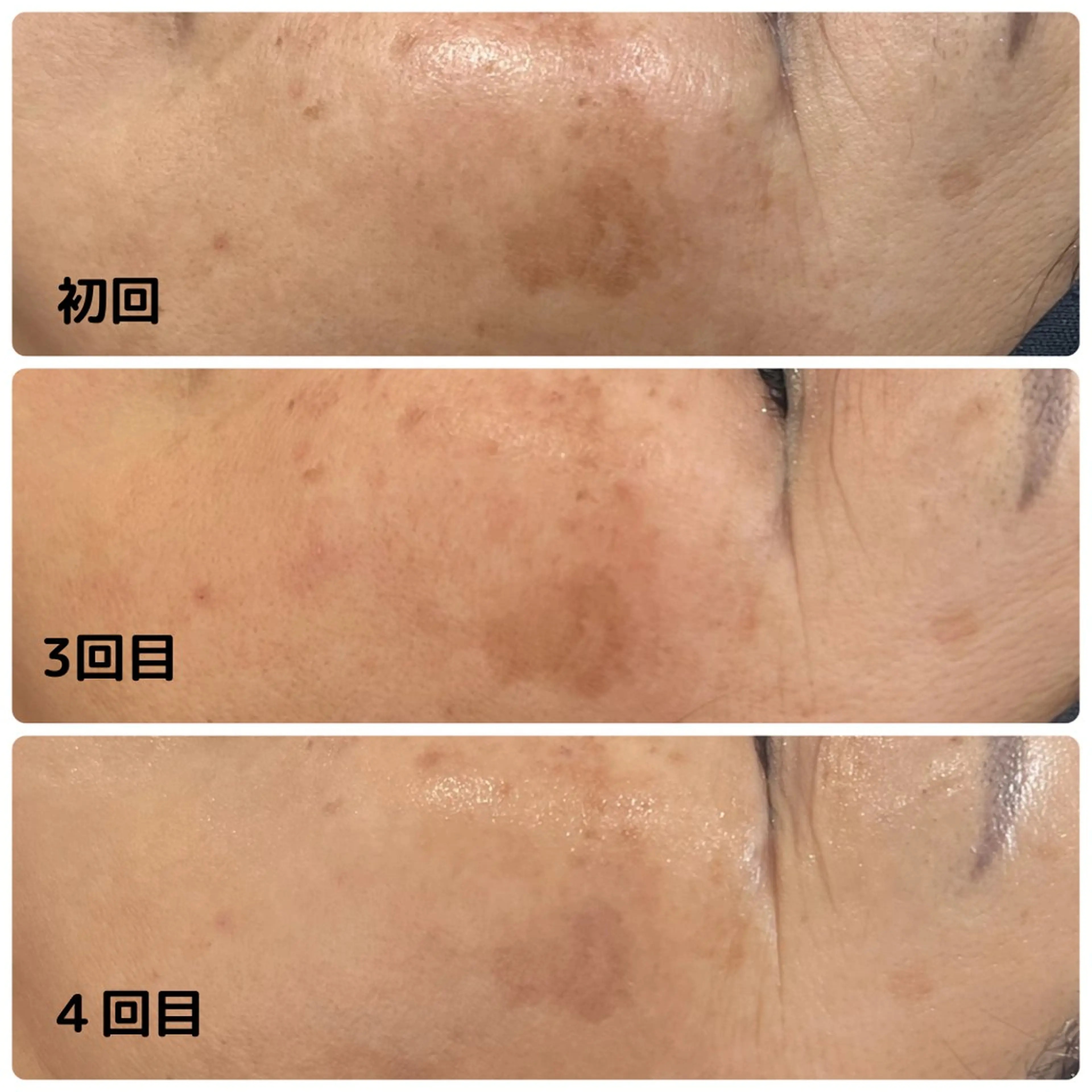 エステ 光フェイシャル・脱毛 MIA.ROSAのエステ・リラクイメージ